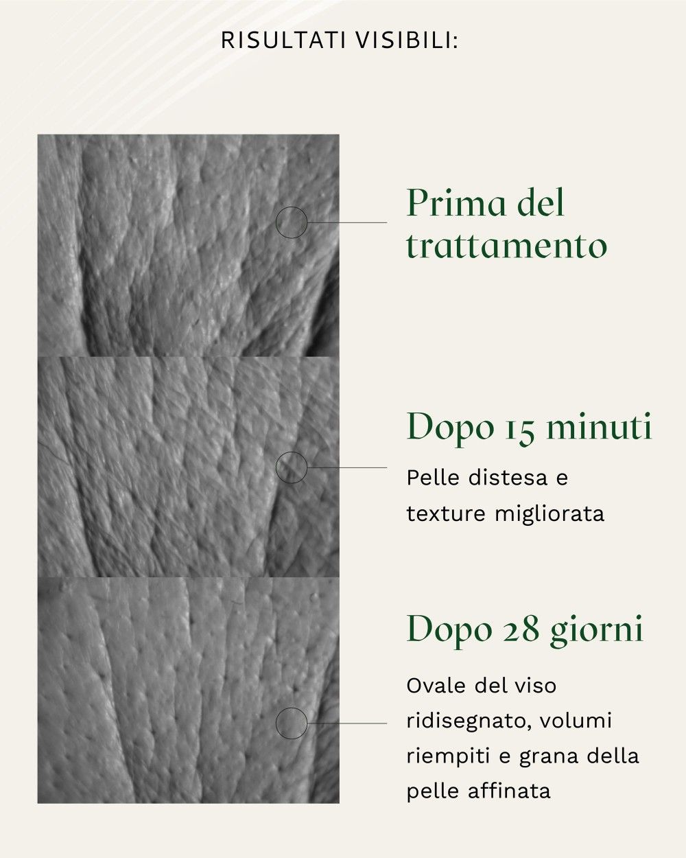 Primo piano della pelle. Mostra i cambiamenti prima e dopo il trattamento. Scritta: Prima del trattamento, Dopo 15 minuti, Dopo 28 giorni.