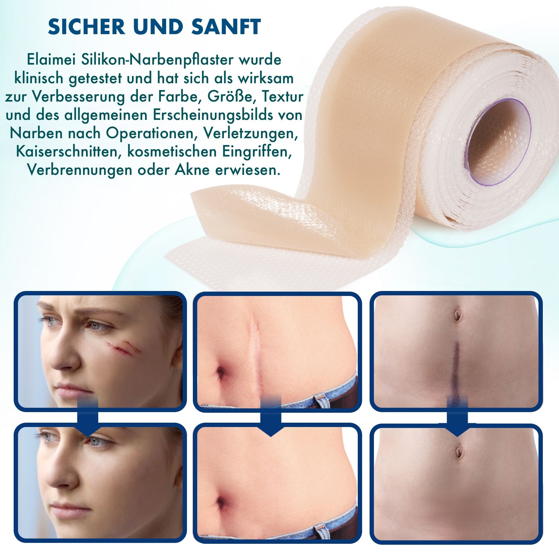 Rotolo di cerotti in silicone beige. Utilizzo per cicatrici post-operatorie, lesioni, tagli cesarei, ustioni.