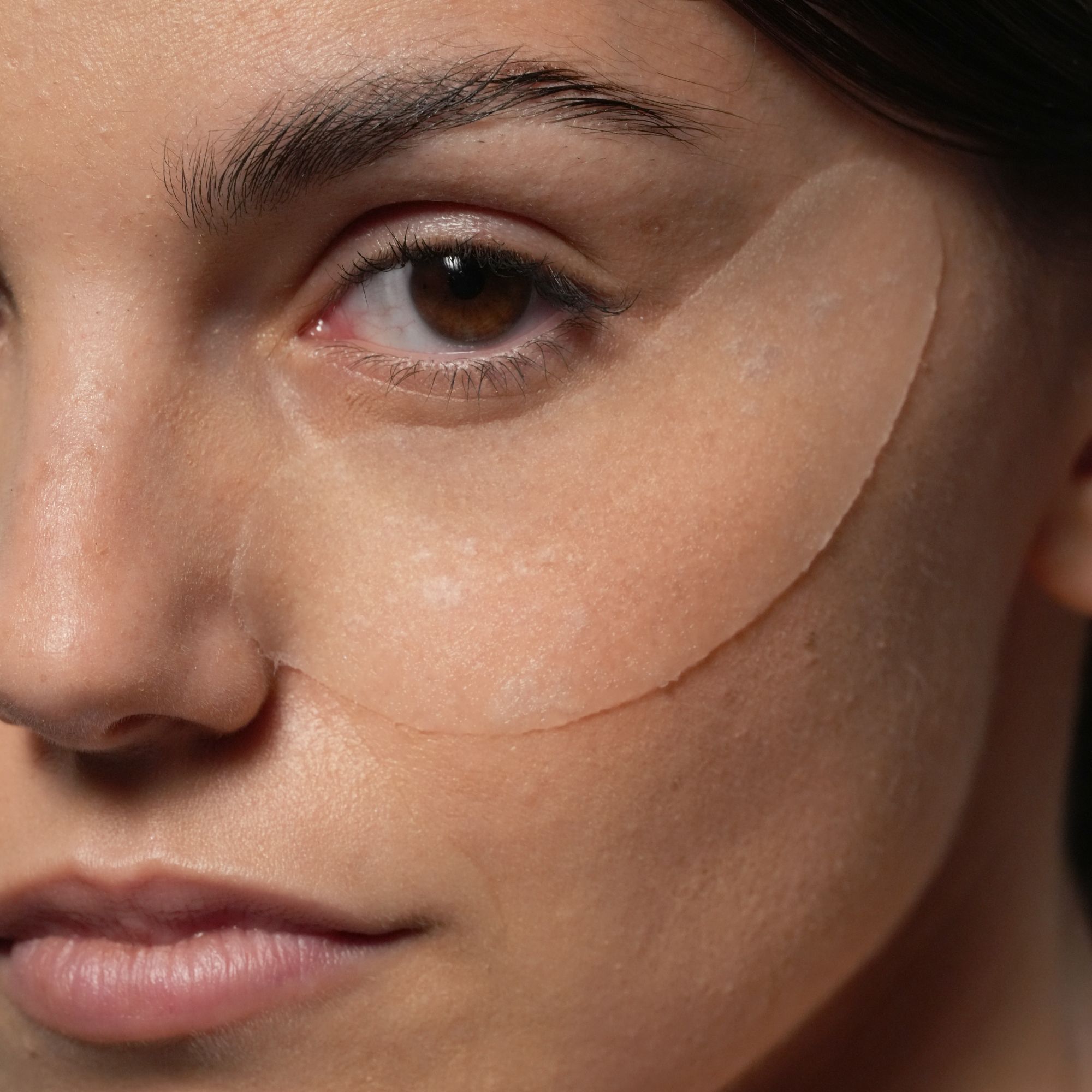 Primo piano di una donna con patch oculari trasparenti sotto gli occhi.