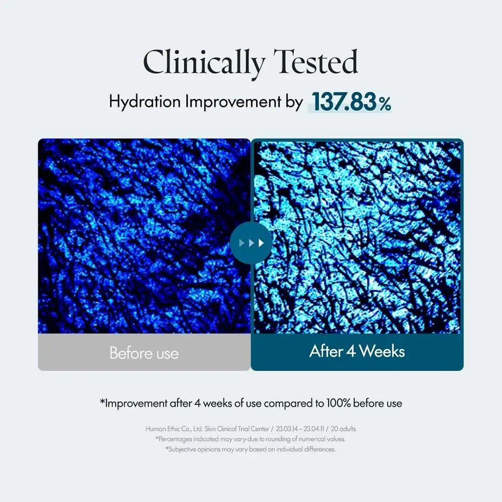 Due immagini blu affiancate. Testo: Miglioramento dell'idratazione del 137,83%. Confronto prima/dopo 4 settimane.