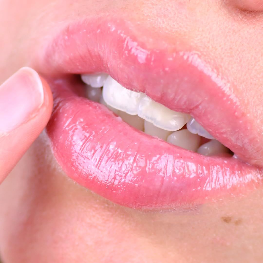 Primo piano di labbra lucide. Un dito tocca le labbra. I denti sono parzialmente visibili.