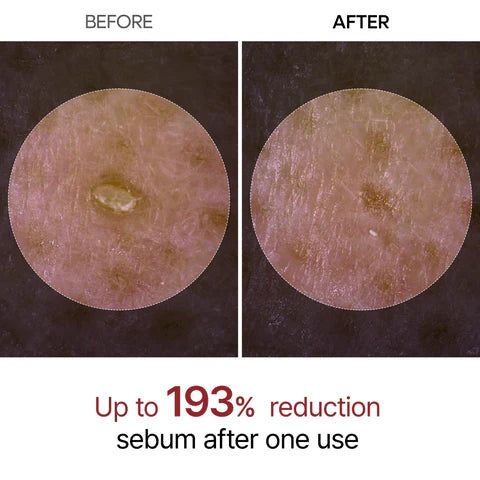 Confronto prima e dopo della texture della pelle dopo l'uso del peeling.