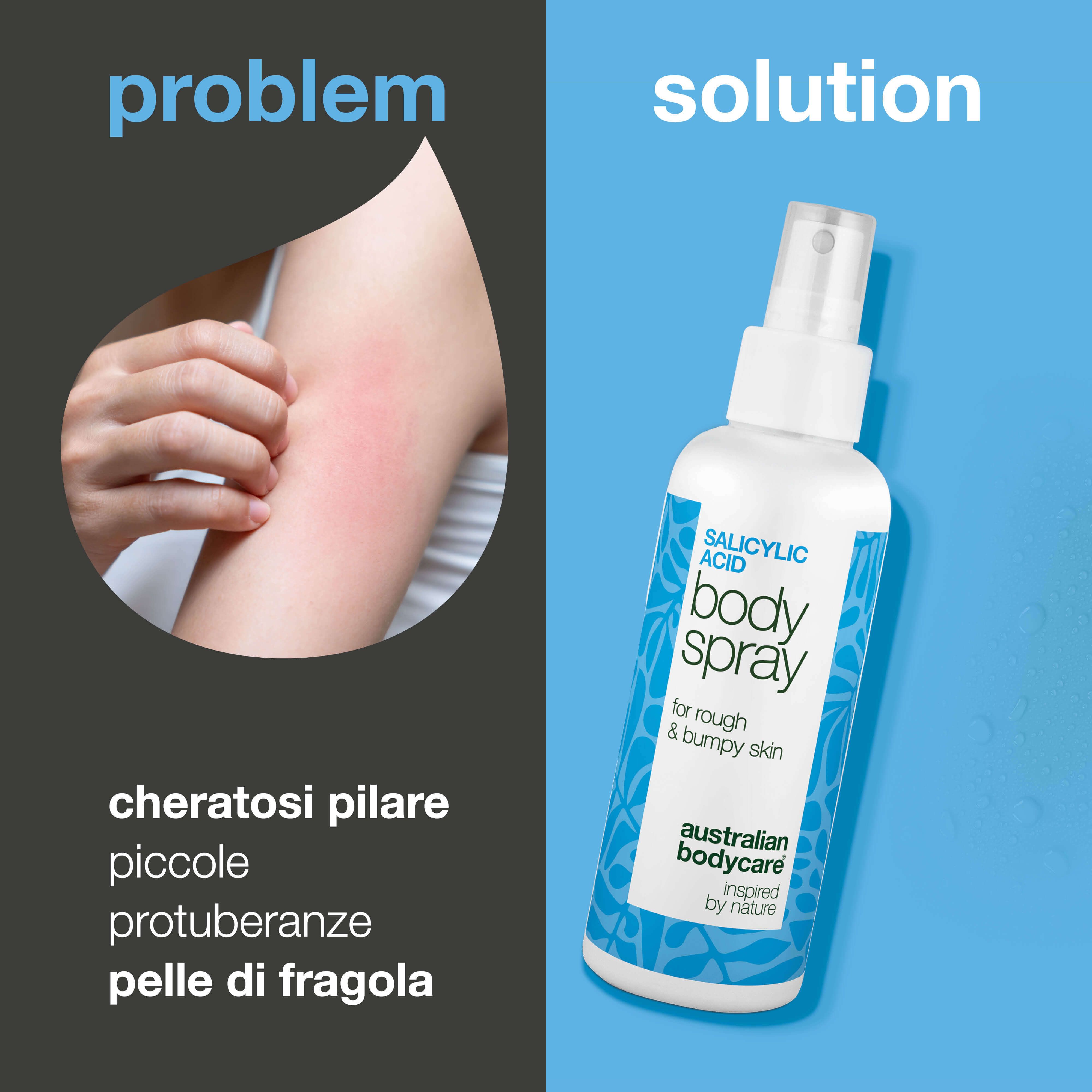 Braccio con eruzione cutanea accanto allo spray. Testo: Salicilico Body Spray, Australian Bodycare.