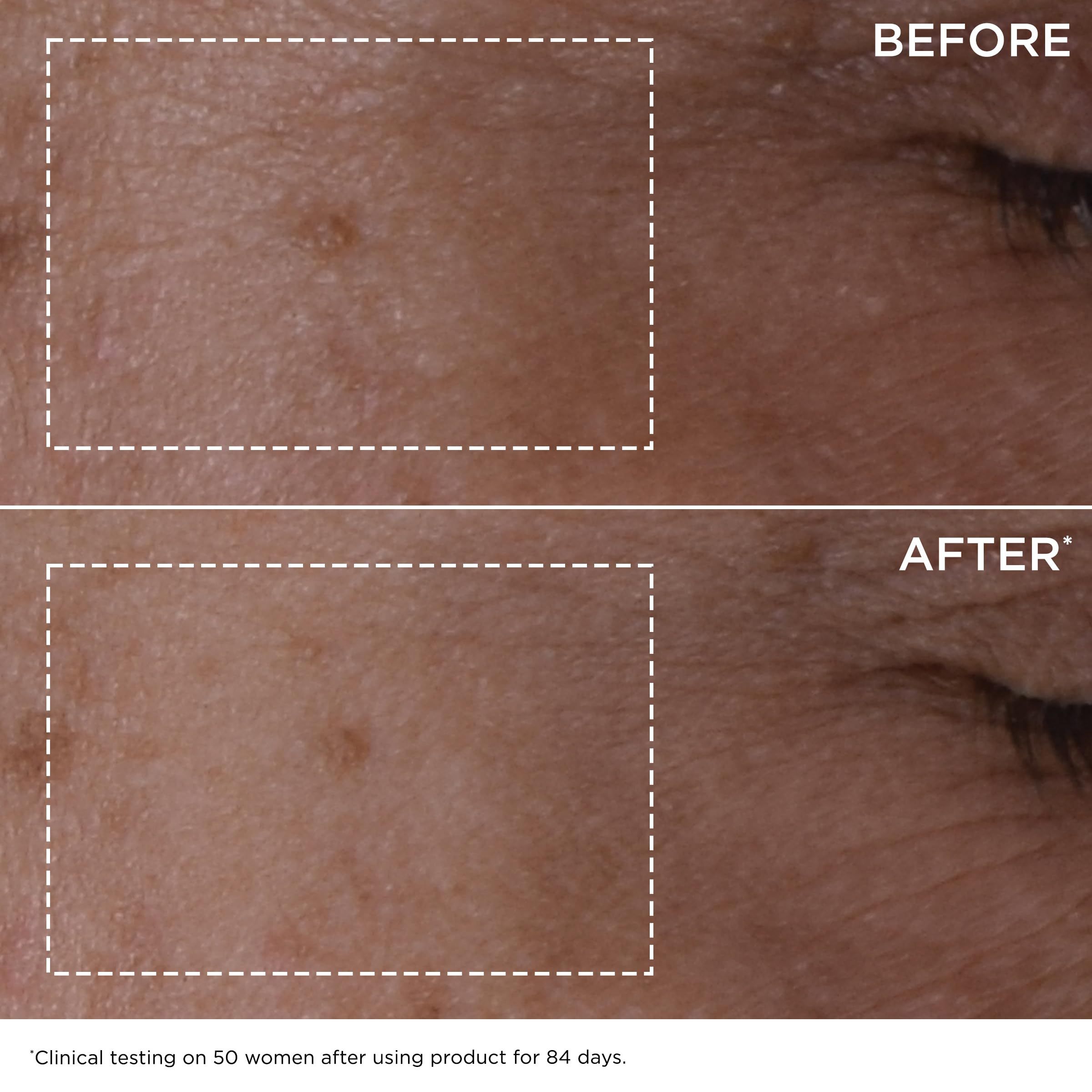 Confronto prima-dopo della pelle. Sopra: prima dell'uso. Sotto: dopo l'uso. Testo: Clinical testing.