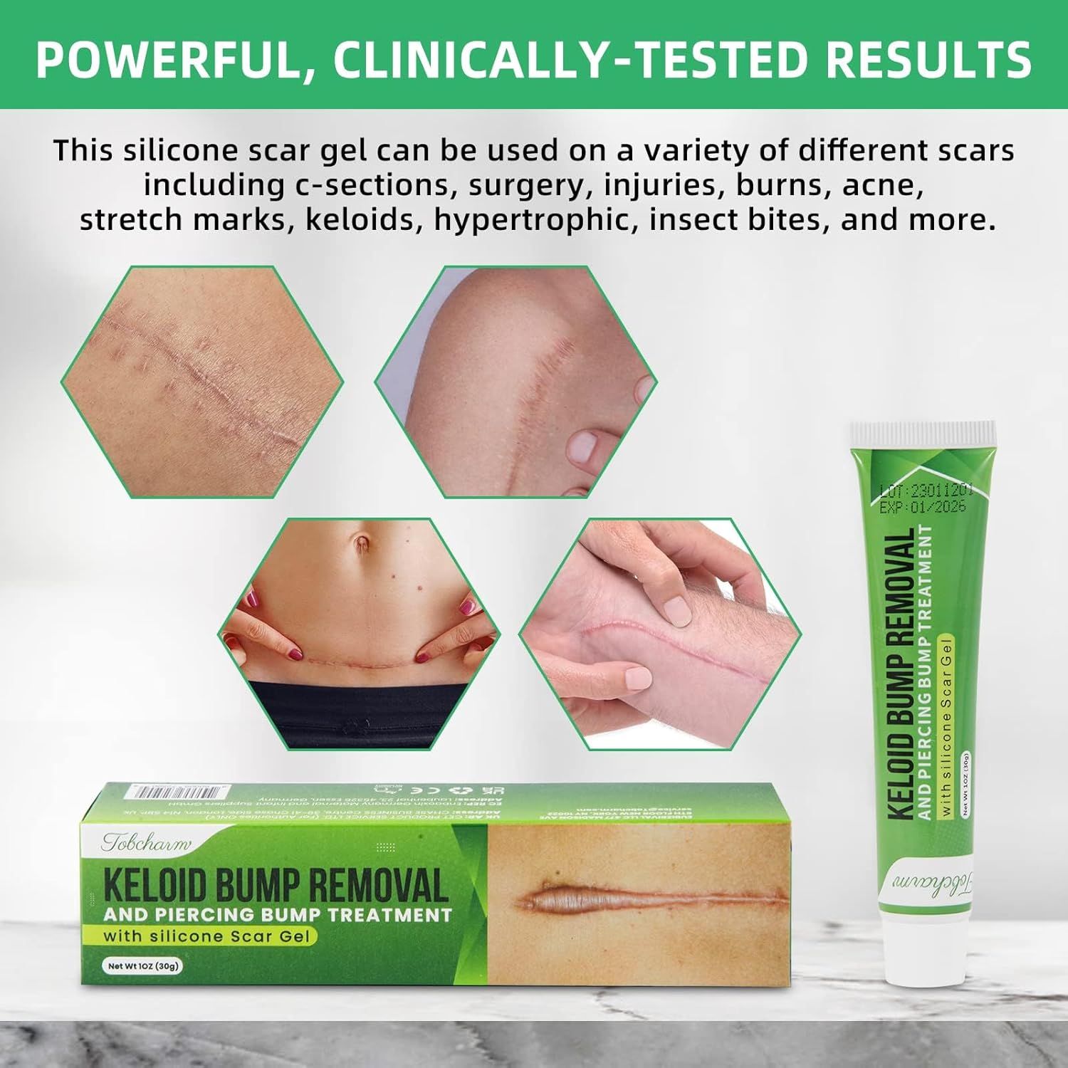 Prodotto e immagini di cicatrici. Testo: Risultati clinicamente testati. Keloid Bump Removal. Con gel per cicatrici al silicone.