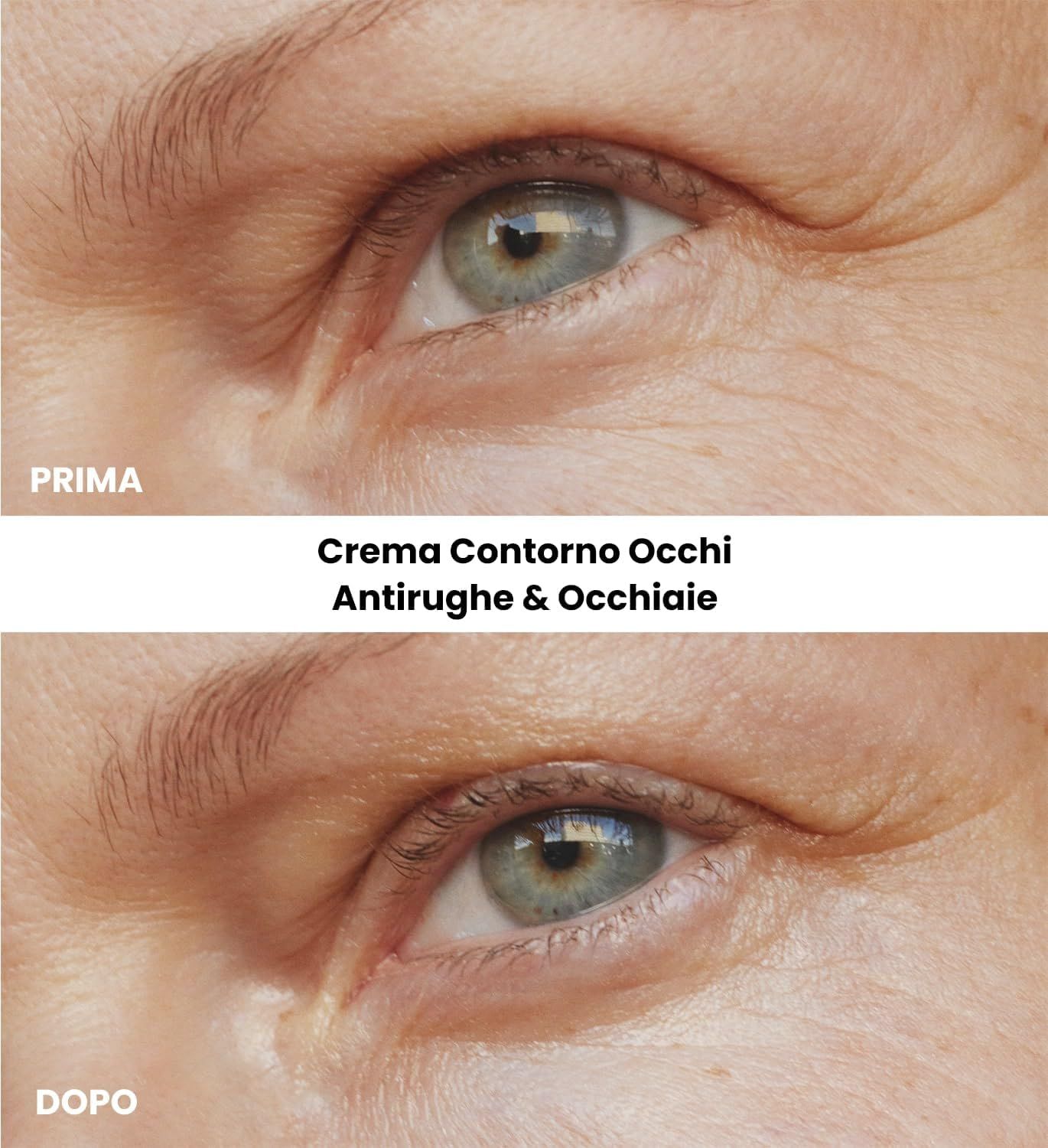 Immagine prima-dopo. Testo: Crema Contorno Occhi Antirughe & Occhiaie. Contorno occhi.