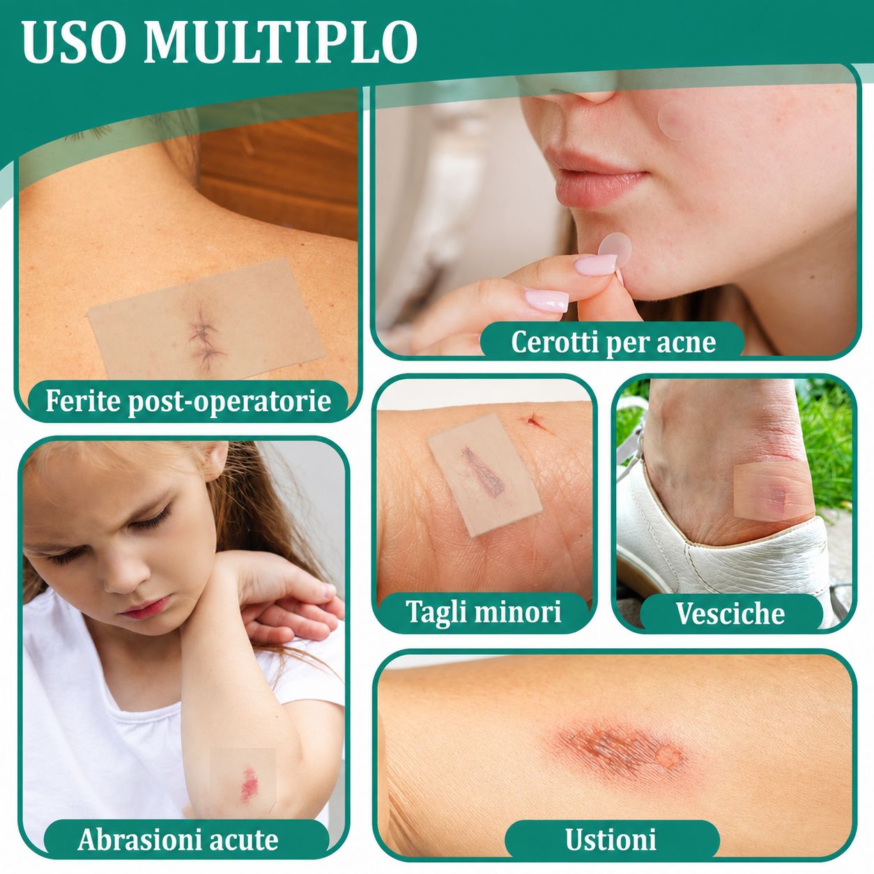 Esempi di utilizzo dei cerotti: post-operatorio, piccoli tagli, vesciche, abrasione acuta, ustione. Diverse zone della pelle.