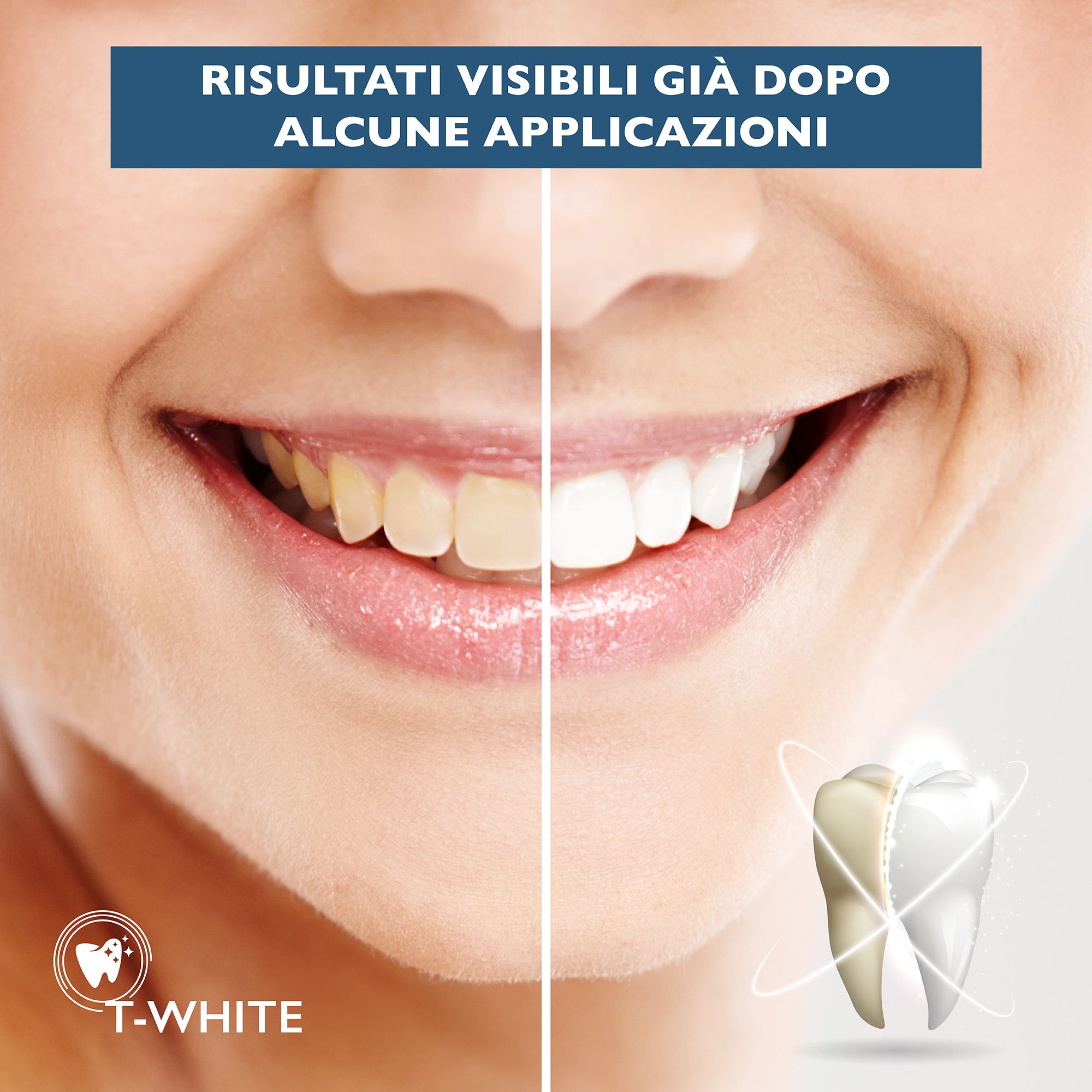 T-White Kit Ricarica Sbiancante Denti