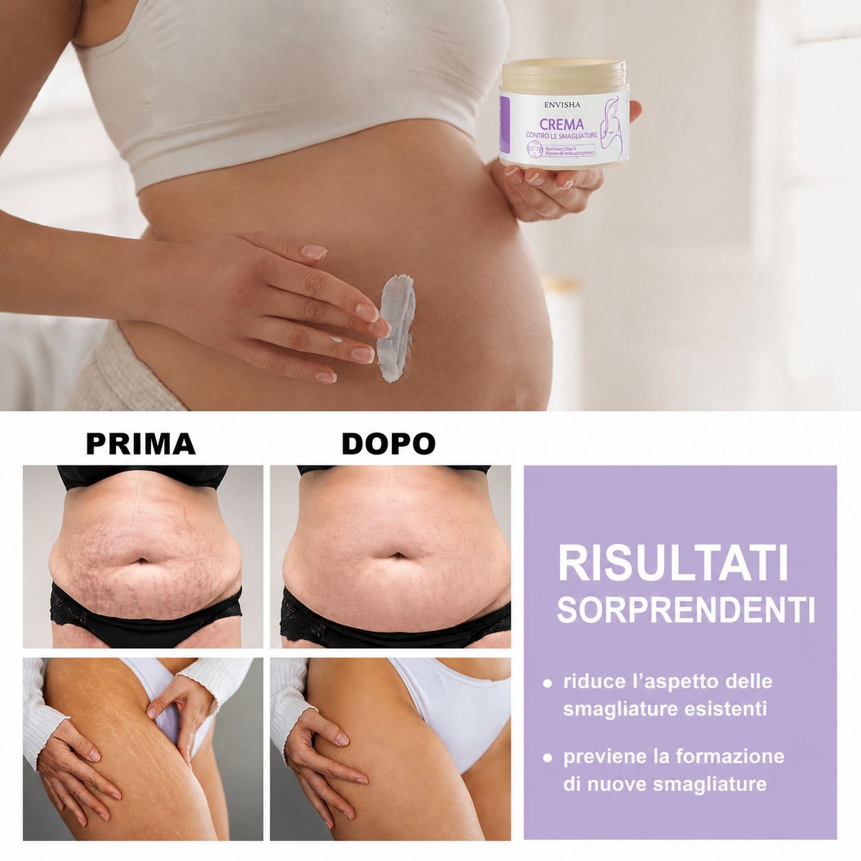 Vasetto di crema ENVISHA e applicazione. Foto prima-dopo delle smagliature. Testo: Risultati sorprendenti.