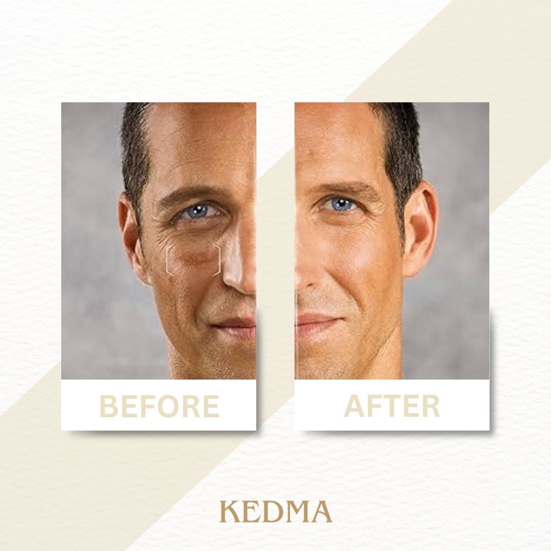 Kedma - Siero Viso Uomo con Minerali del Mar Morto