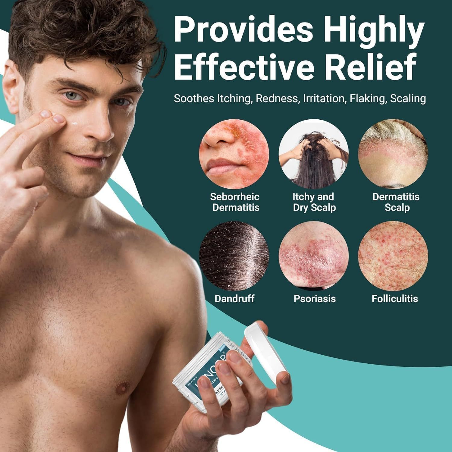 LMNOOP crema per dermatite seborroica trattamento intensivo per il cuoio capelluto