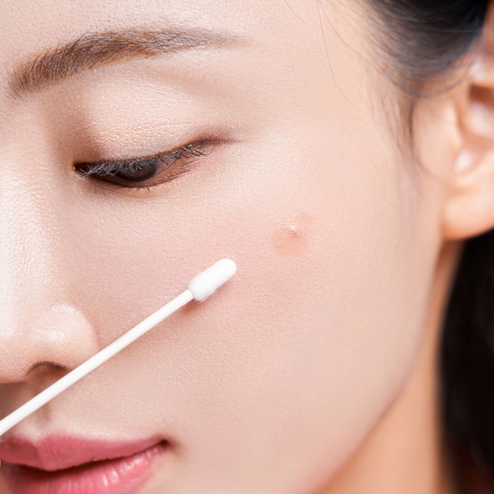 Primo piano di un viso. Un cotton fioc tocca un'imperfezione della pelle. Tono della pelle.