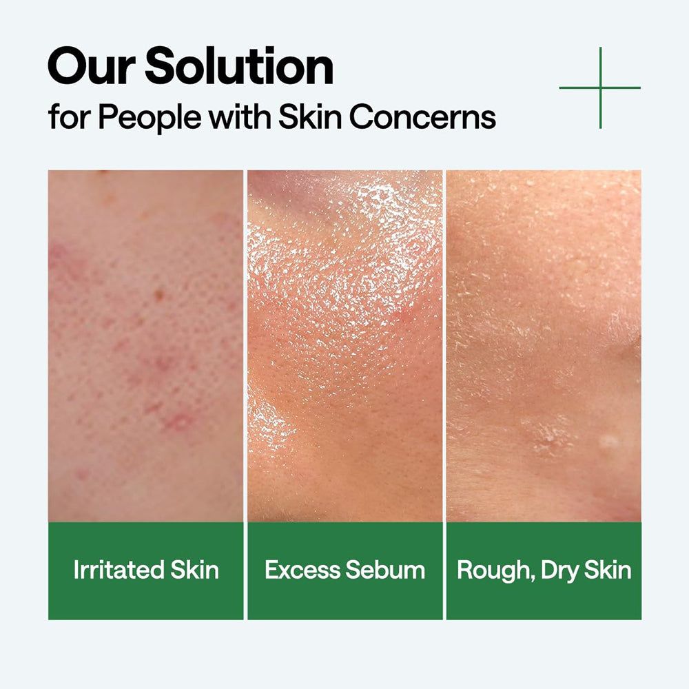 Tre immagini della pelle: pelle irritata, eccesso di sebo, pelle ruvida e secca. Testo: Our Solution for People with Skin Concerns.