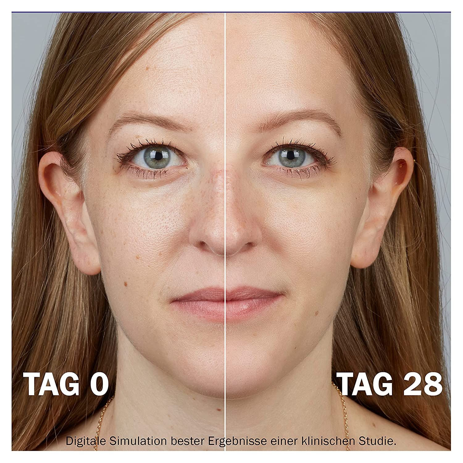 Volto di donna diviso. Sinistra: Giorno 0. Destra: Giorno 28. Testo: Simulazione digitale dei migliori risultati.
