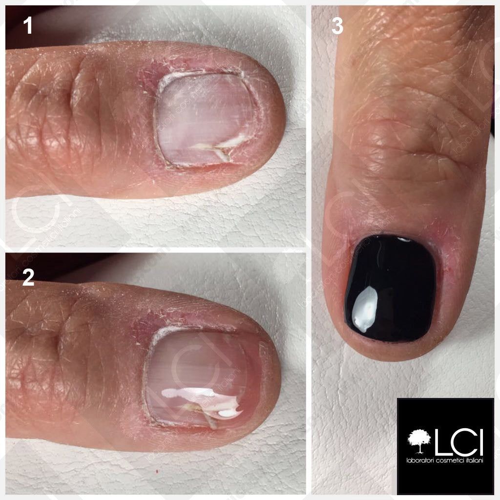 Tre primi piani di un dito. L'unghia è trattata con un gel nero.
