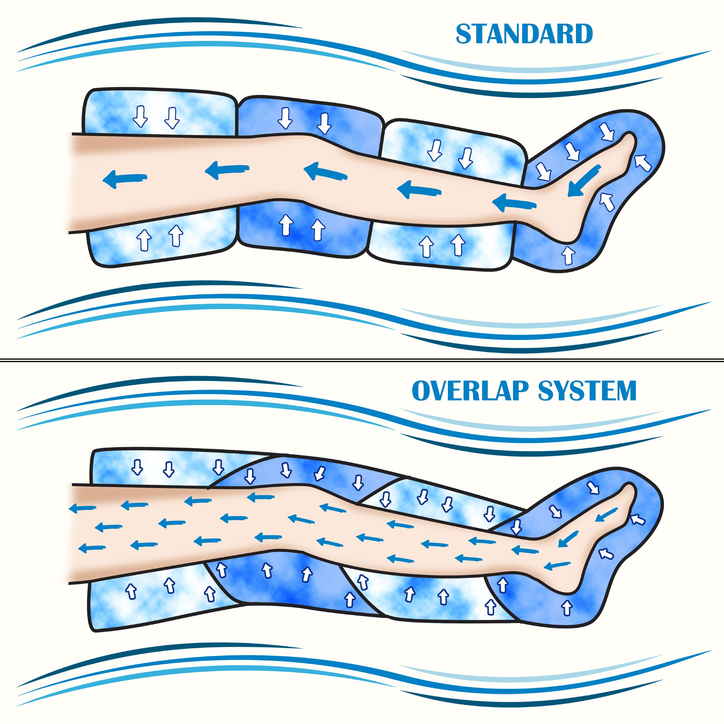 Illustrazione di una gamba in un manicotto di compressione con frecce che indicano il flusso d'aria. Etichetta: STANDARD.