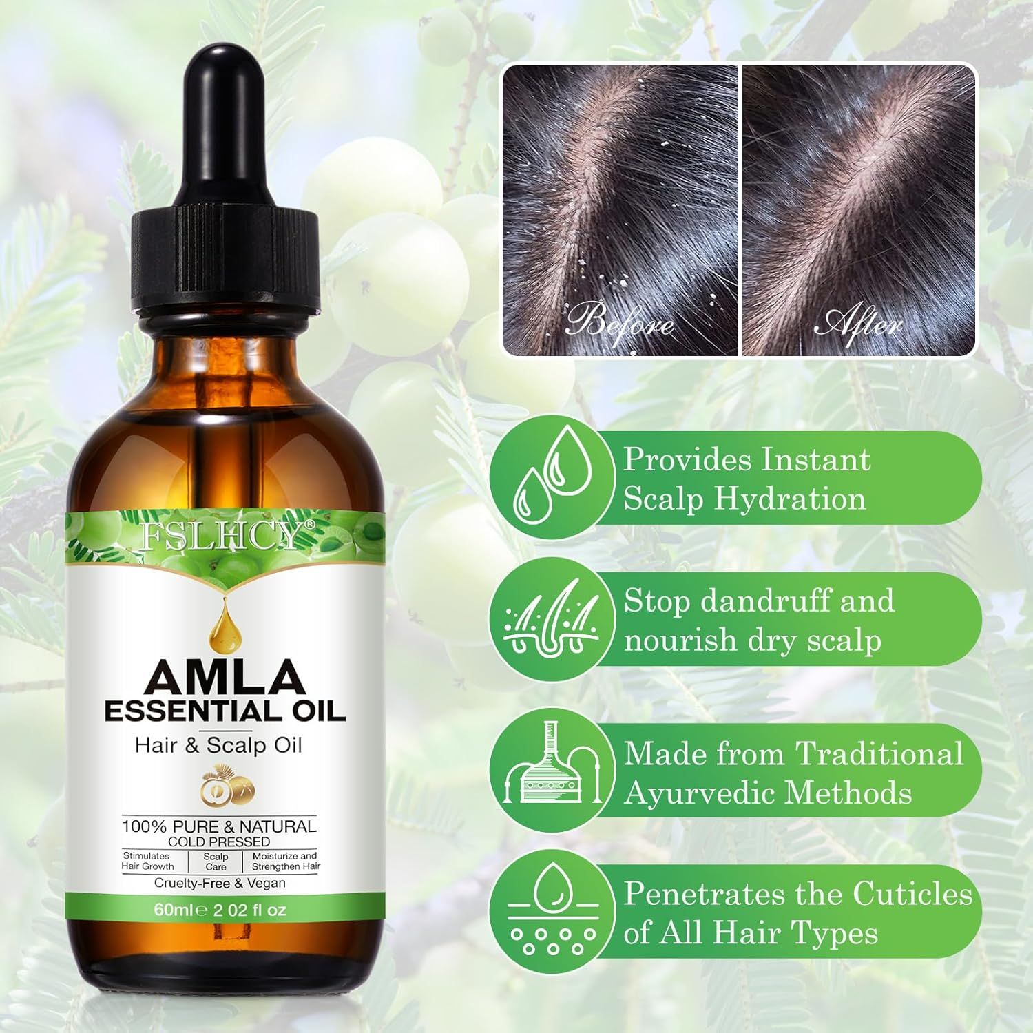 Flacone di vetro marrone con Amla Essential Oil. Contagocce. Immagini prima/dopo del cuoio capelluto. Testo: FSLHCY, Amla Essential Oil, 100% Pure & Natural.