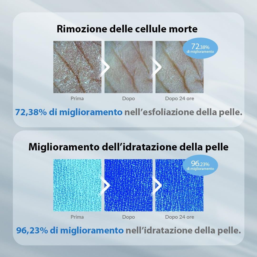 Confronti prima-dopo. Effetto peeling: miglioramento del 72,38%. Idratazione: miglioramento del 96,23%.