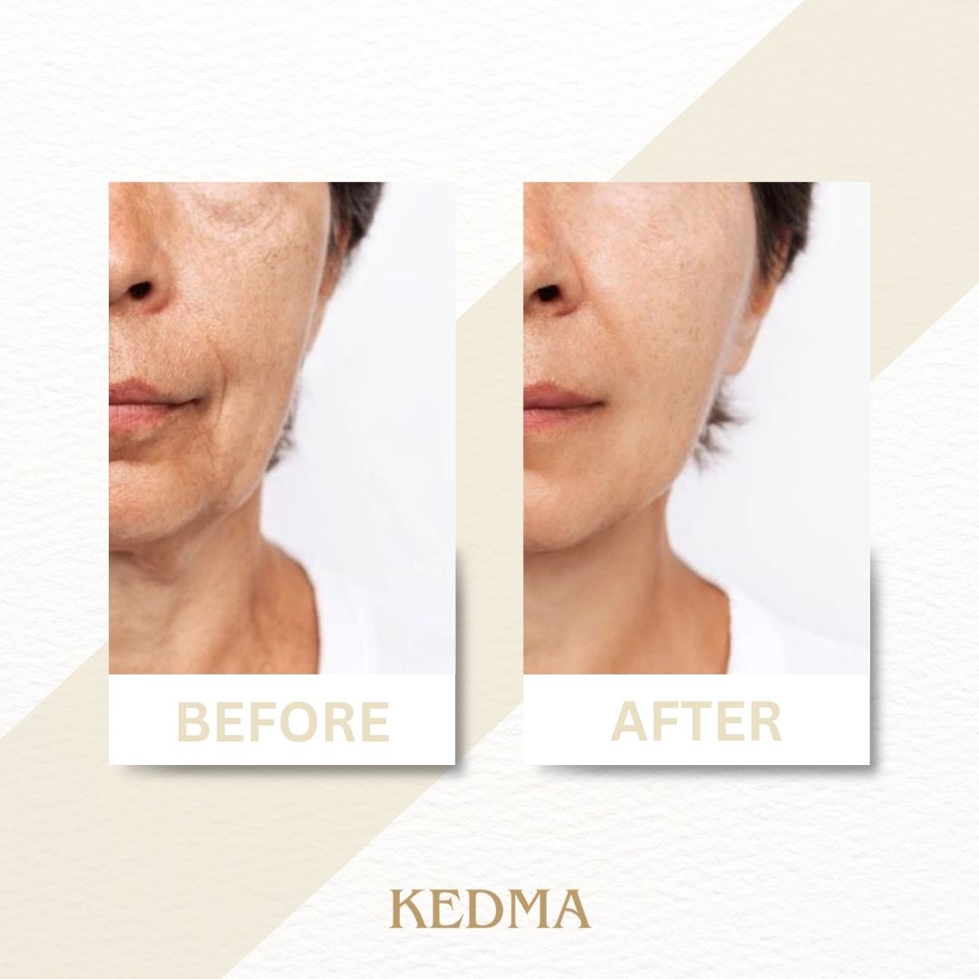 Kedma - Crema Royalty con Minerali del Mar Morto e Collagene