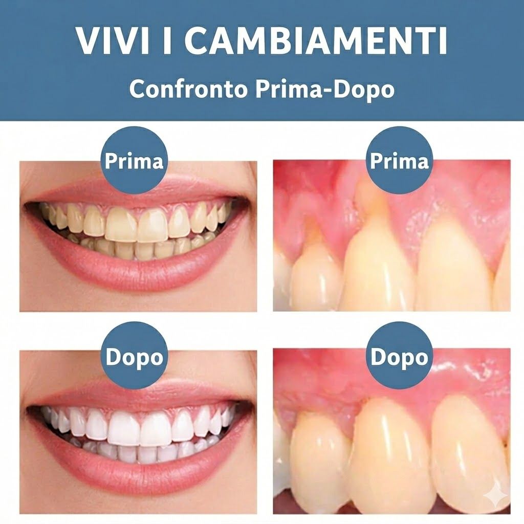 SUMMISHI Spray e Gocce Riparatrici per le Gengive