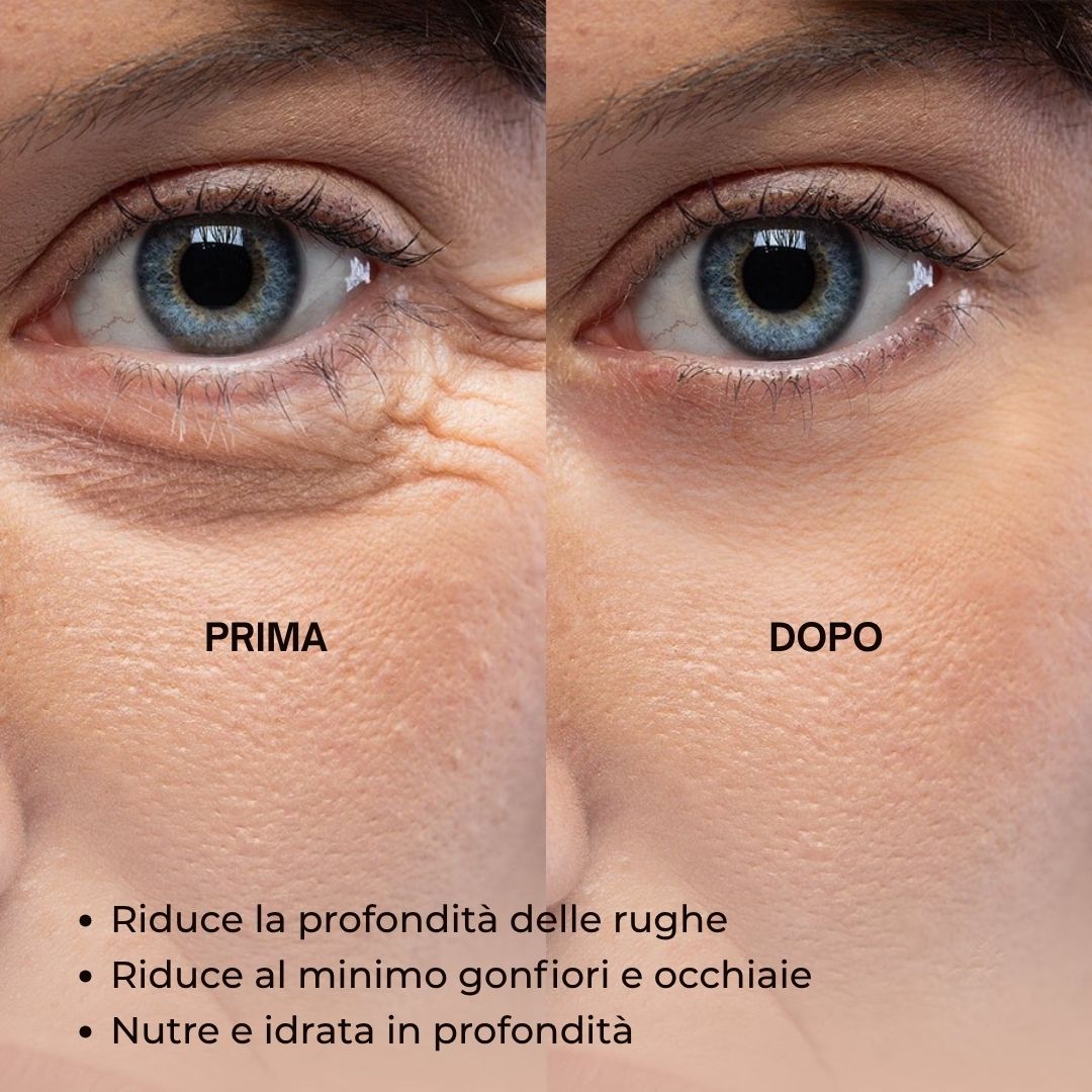 Confronto prima-dopo delle zone degli occhi. Scritta: Prima, Dopo. Testo sotto: Riduce la profondità delle rughe, ecc.