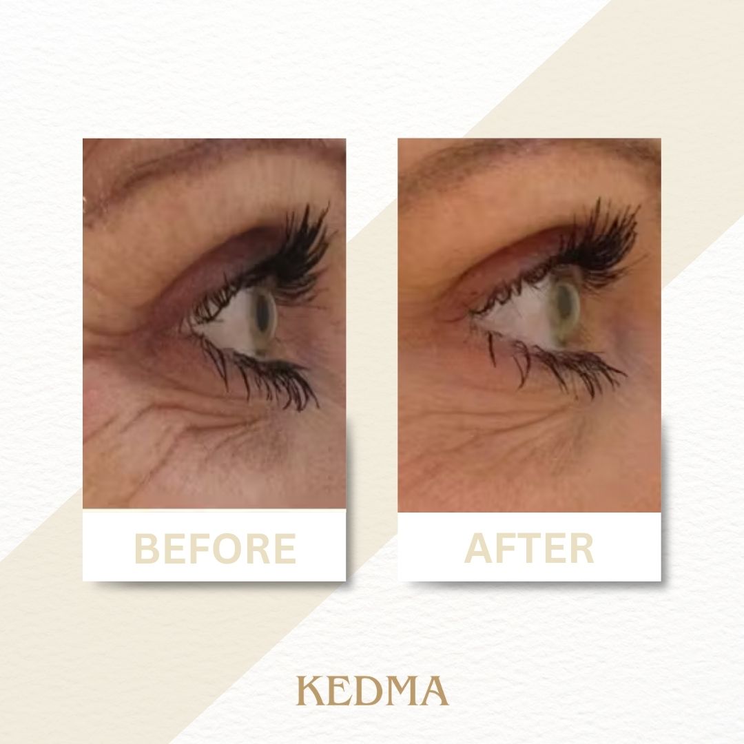 Kedma - Crema Occhi Anti-Età con Collagene e Minerali del Mar Morto