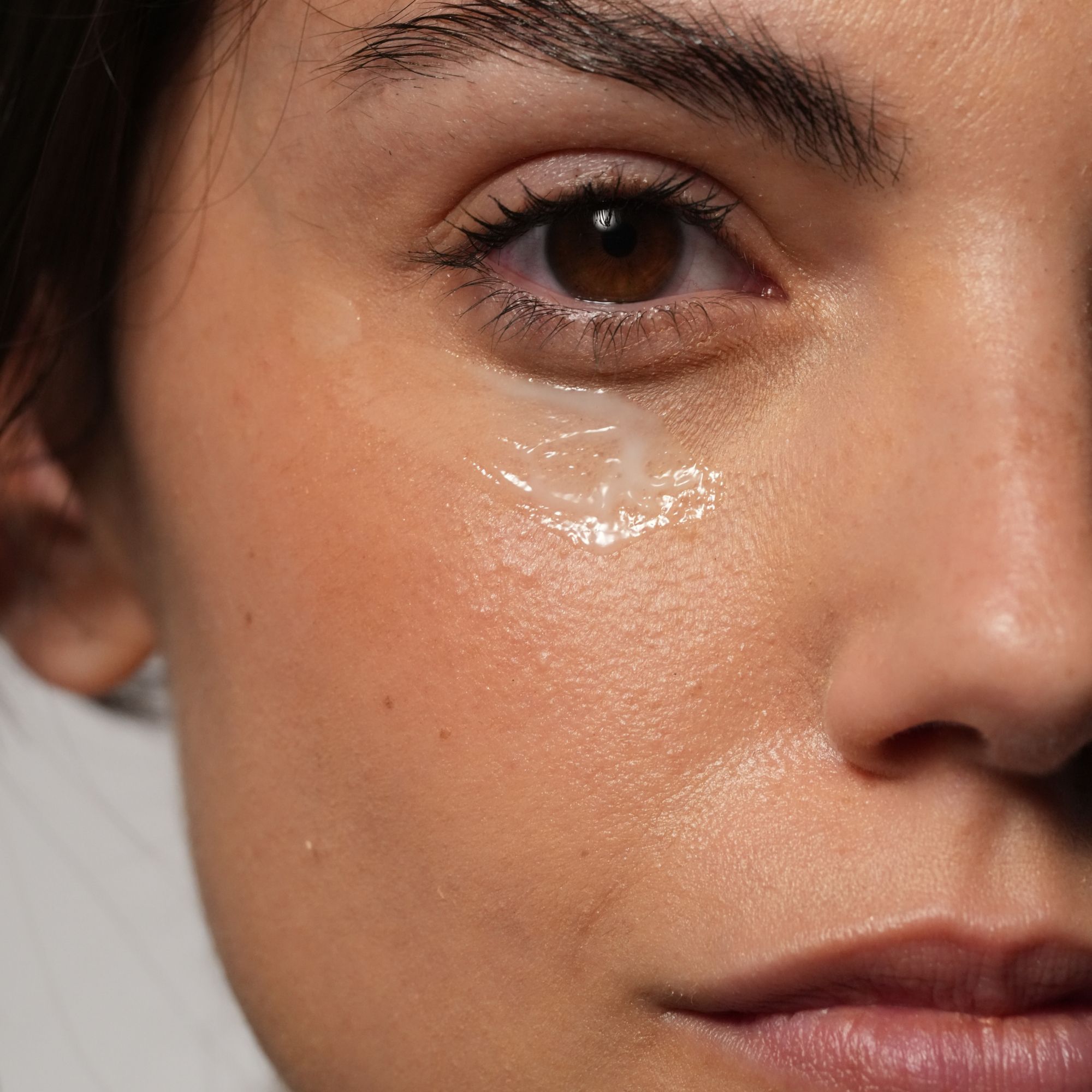 Primo piano di un occhio con crema trasparente applicata.
