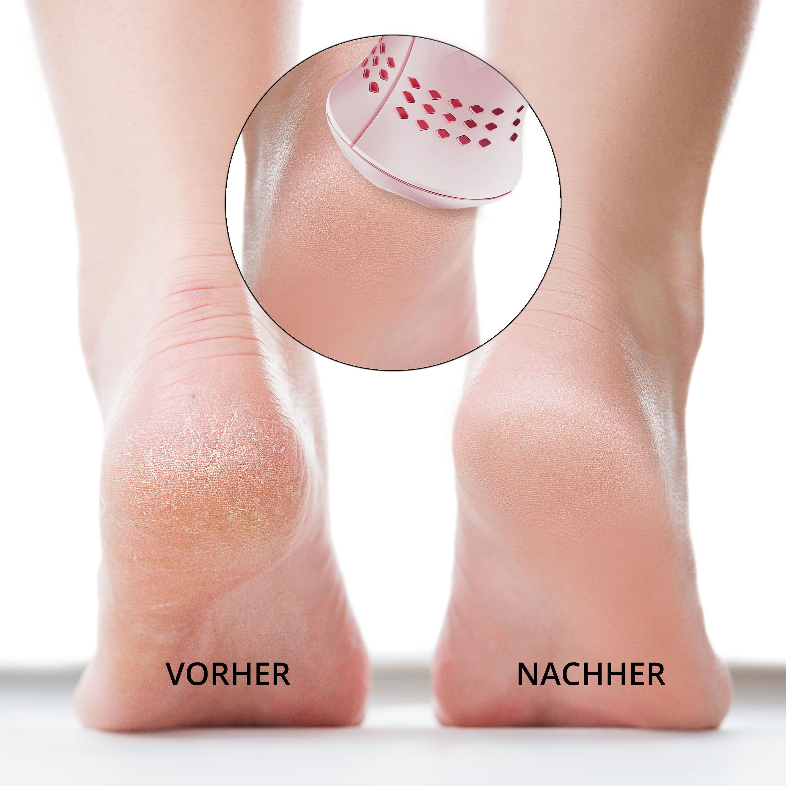 Piedi prima e dopo l'uso. In cerchio: dispositivo. Testo: PRIMA e DOPO.