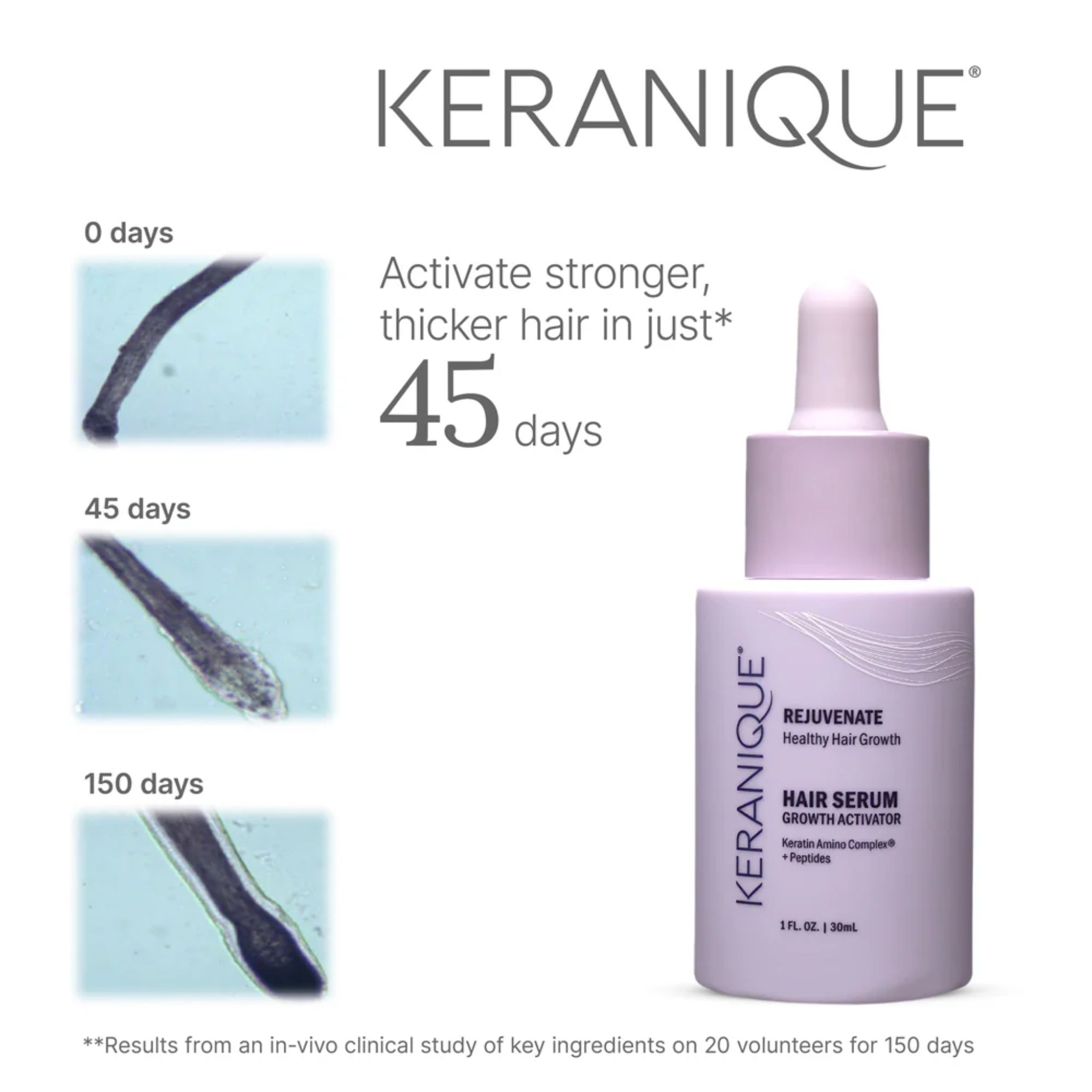 Flacone di siero Keranique. Mostra i cambiamenti dei capelli dopo 45 giorni. Scritta: Hair Serum Growth Activator.
