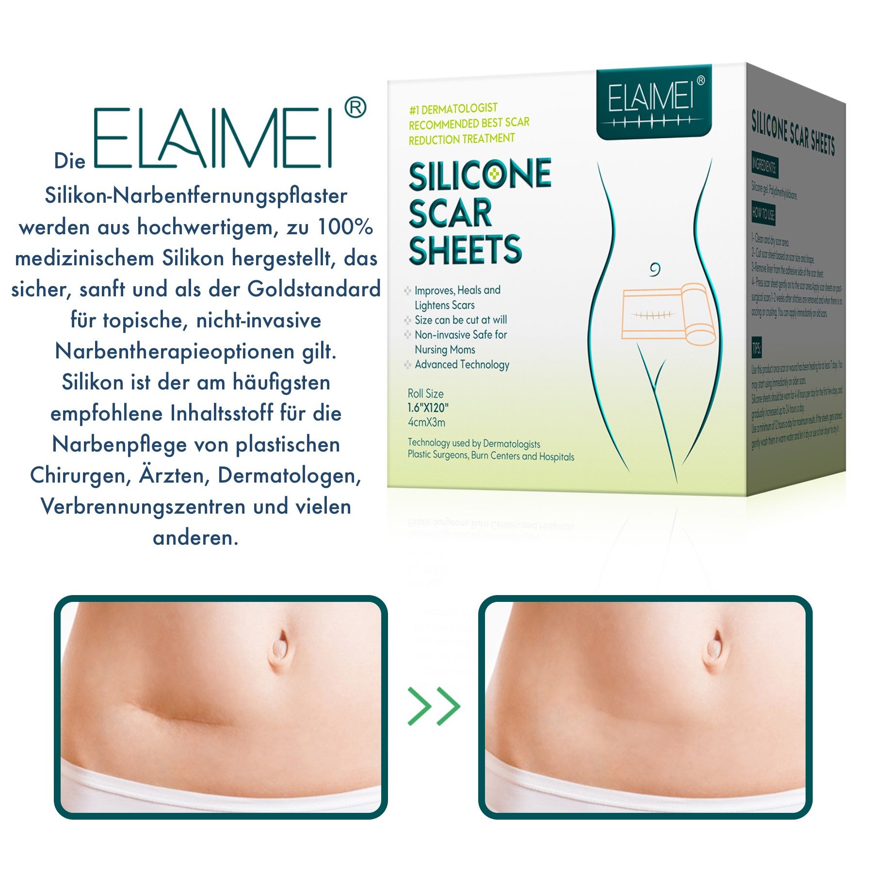 Confezione del prodotto e testo. Testo: Cerotto ELAIMEI per la rimozione delle cicatrici in silicone, realizzato in silicone medicale di alta qualità.