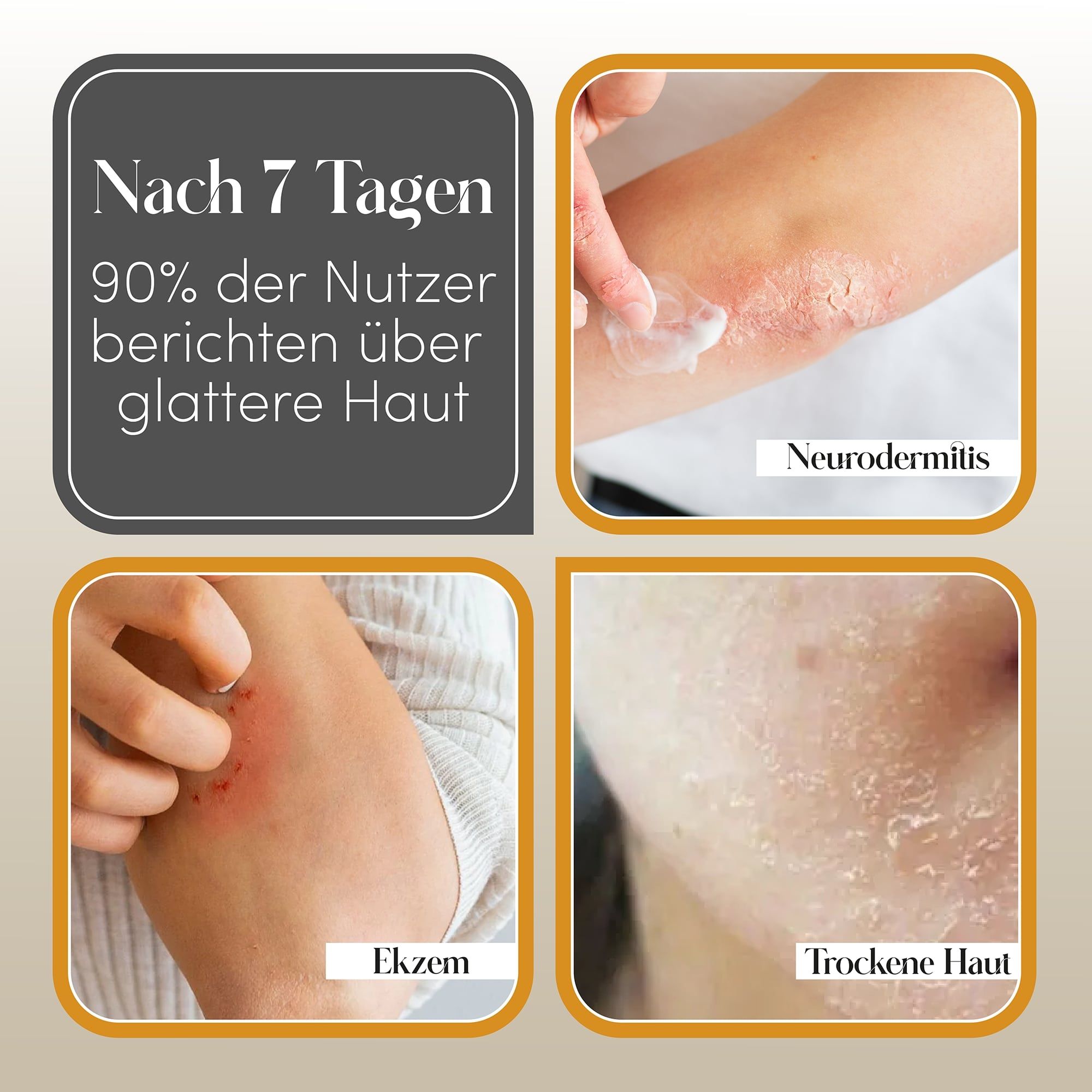 Immagini di problemi della pelle: eczema, pelle secca. Testo: Dopo 7 giorni, il 90% degli utenti riporta una pelle più liscia.