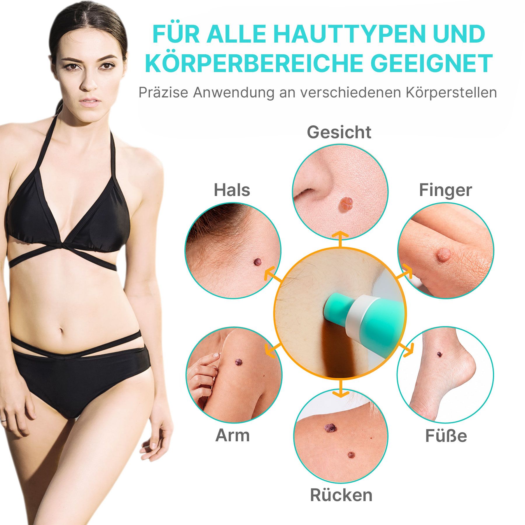 ALIVER Set Penna per il Trattamento delle Verruche e Rimozione di Fibromi Penduli