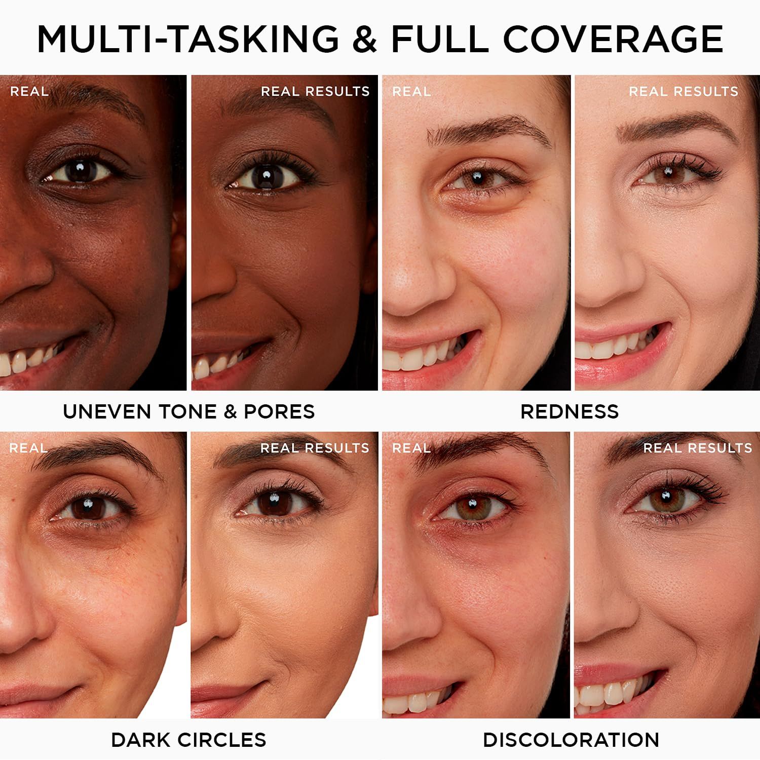 Confronto prima-dopo di volti. Aree: Uneven Tone & Pores, Redness, Dark Circles, Discoloration. Testo: Real Results.