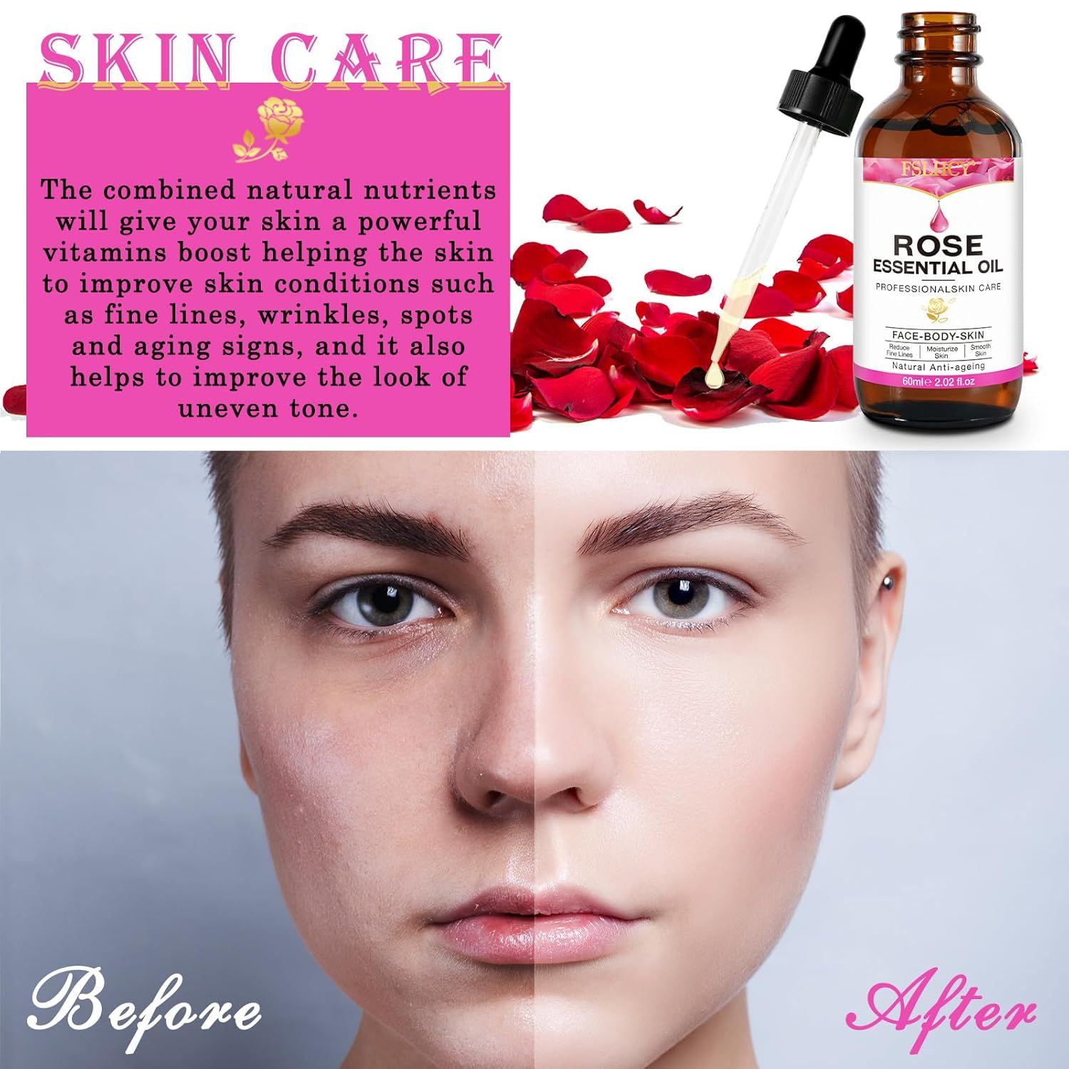 Flacone di vetro marrone con siero e contagocce. Scritta: Rose Essential Oil. Immagine prima-dopo della pelle.