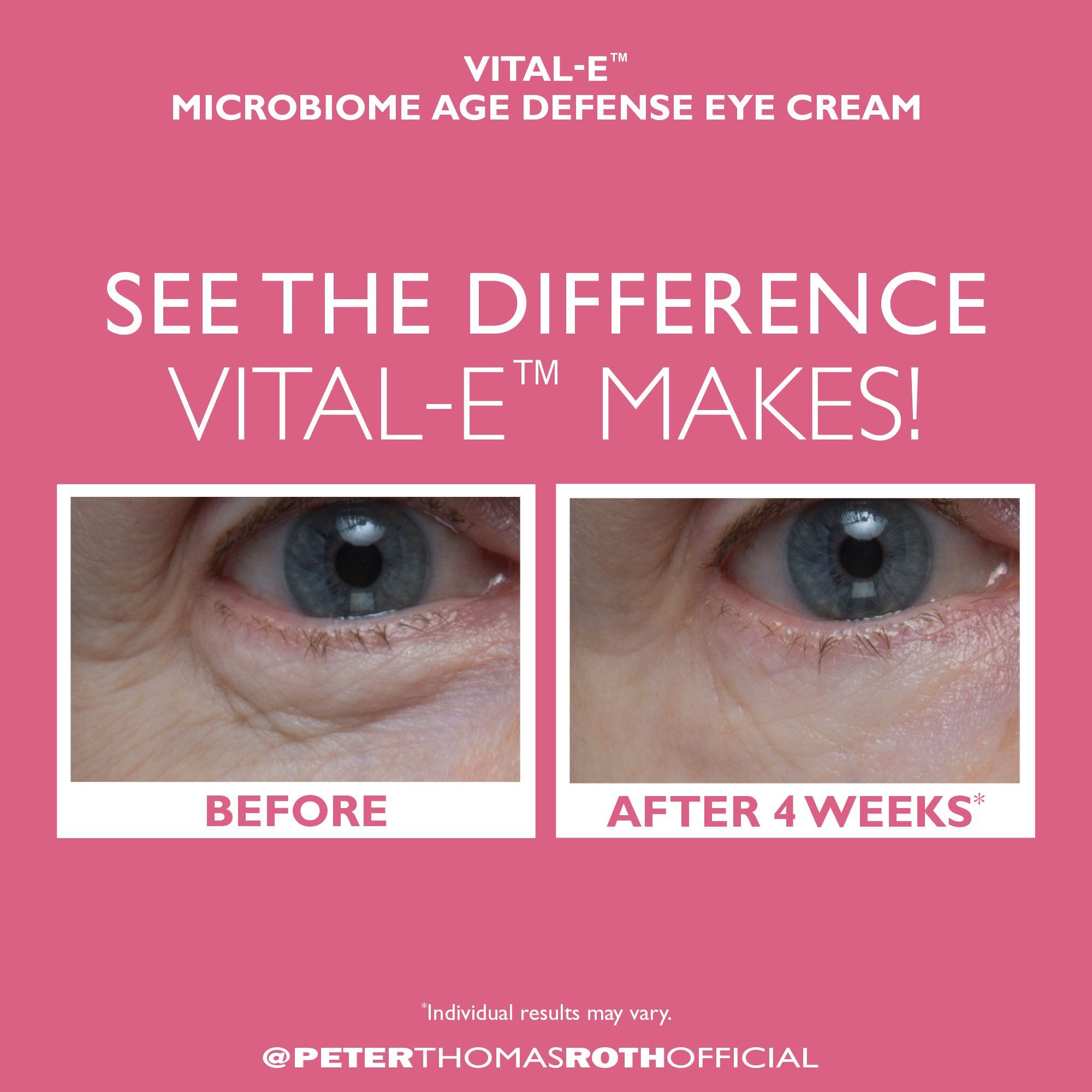 Immagine comparativa: occhi prima/dopo. Testo: VITAL-E fa la differenza. Occhi rugosi, poi più lisci dopo 4 settimane.