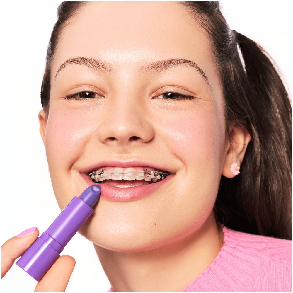 Una ragazza con l'apparecchio tiene un balsamo per labbra viola. Il balsamo per labbra viene applicato sulle labbra.