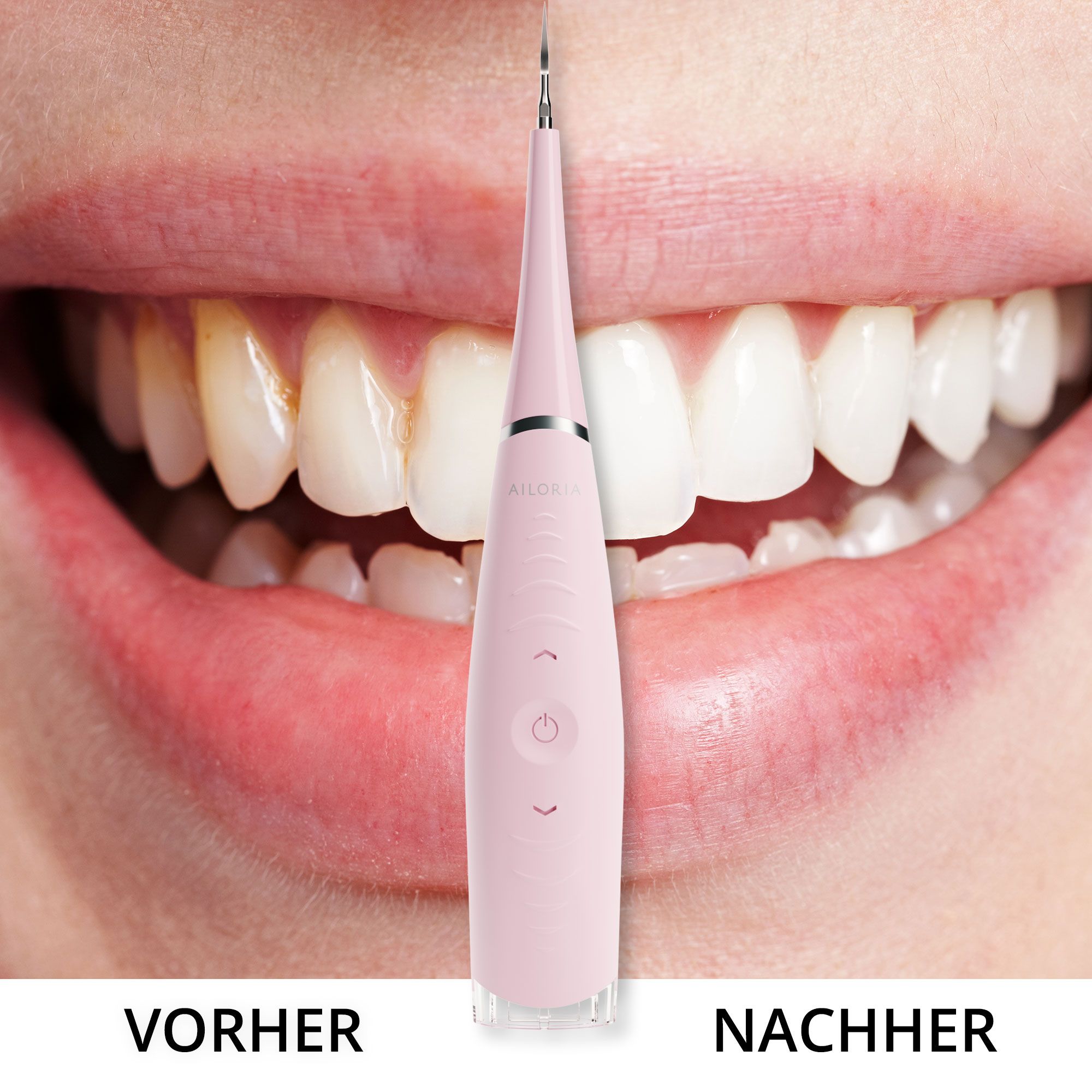 Denti prima e dopo la pulizia. Il pulitore è in uso. Testo: PRIMA, DOPO.