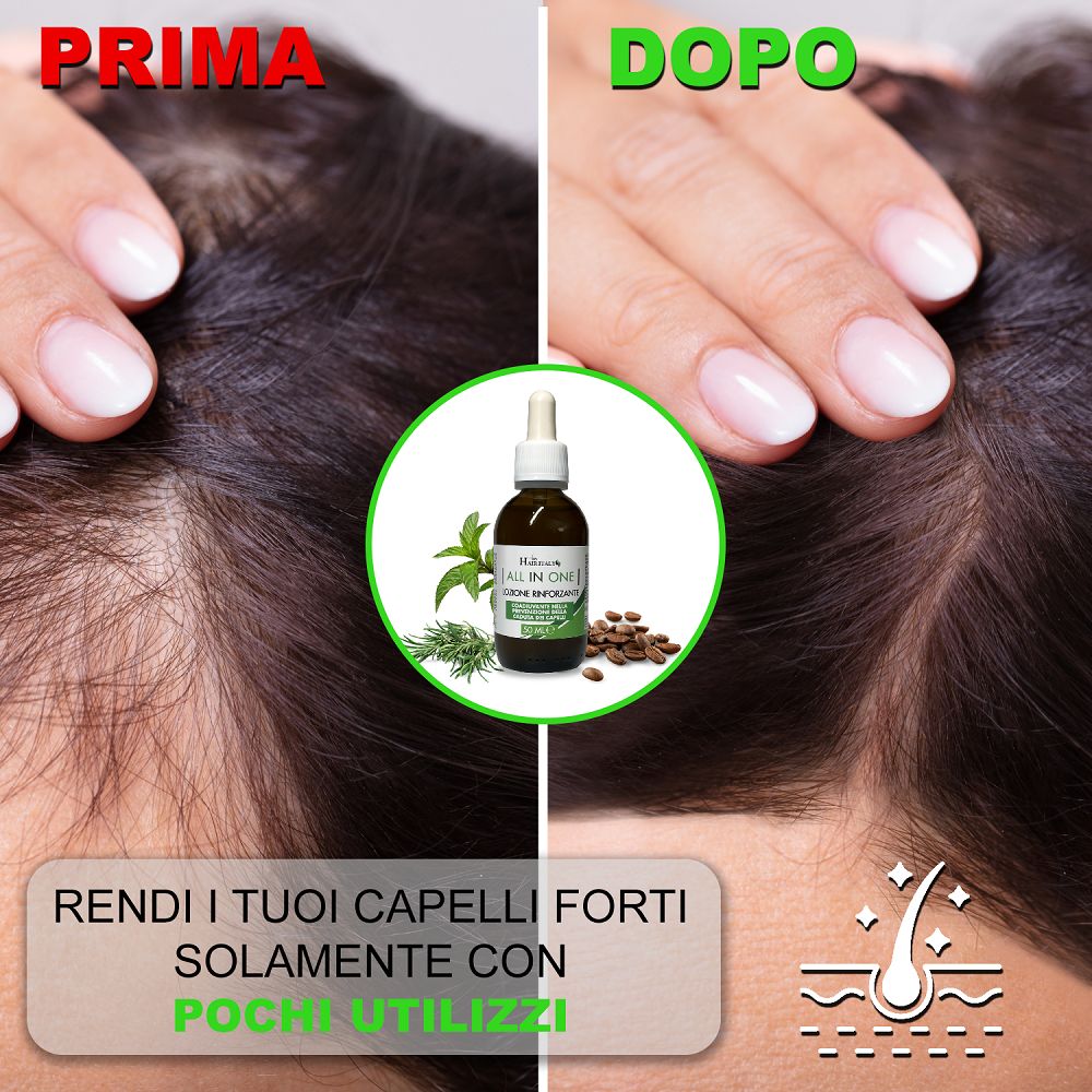 Trico Hair Italy Lozione Anticaduta con Serenoa Repens, Rosmarino e Biotina. Trattamento Ricrescita