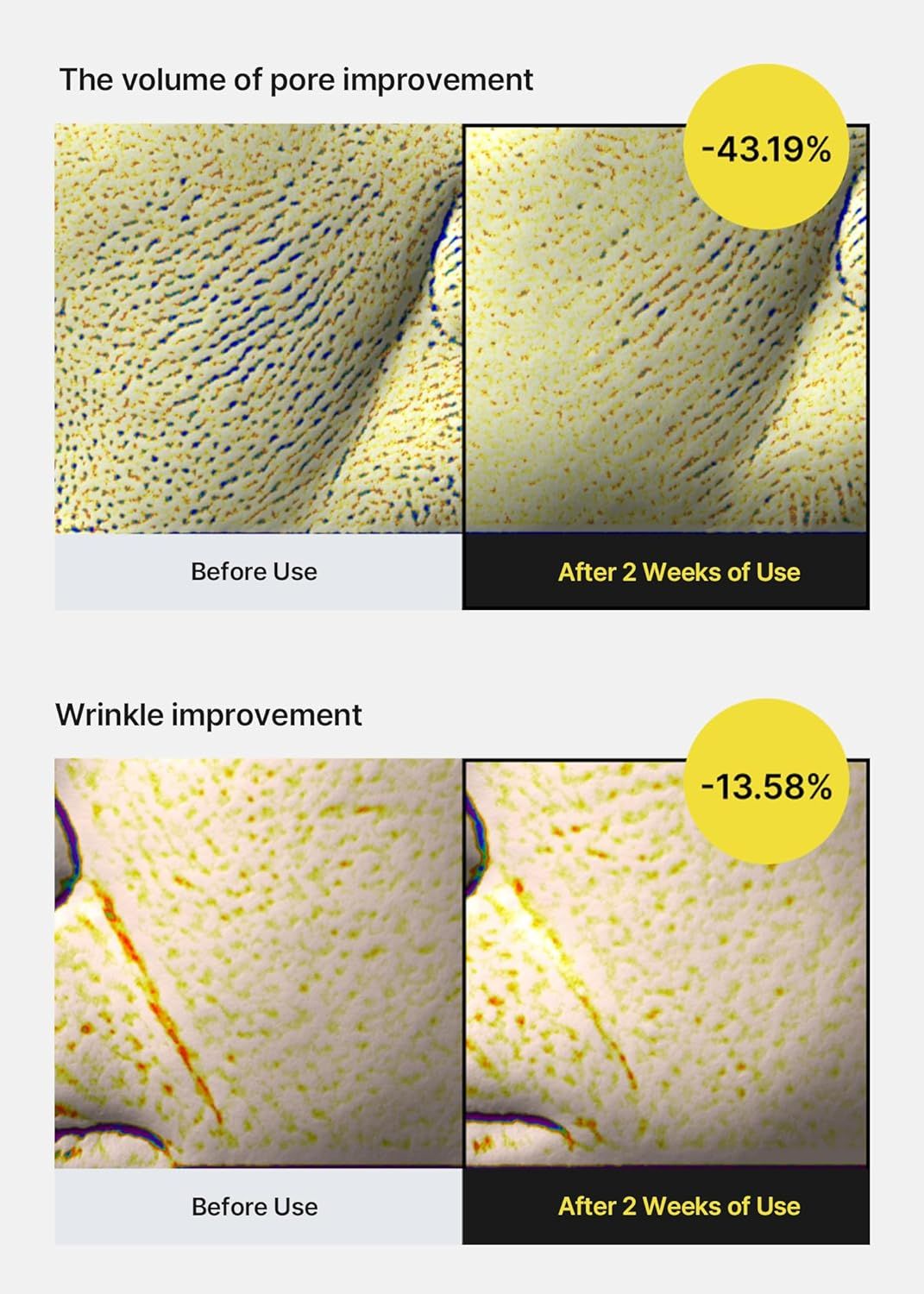 Due immagini comparative. Sopra: pori prima e dopo 2 settimane. Sotto: rughe prima e dopo 2 settimane. Percentuali.
