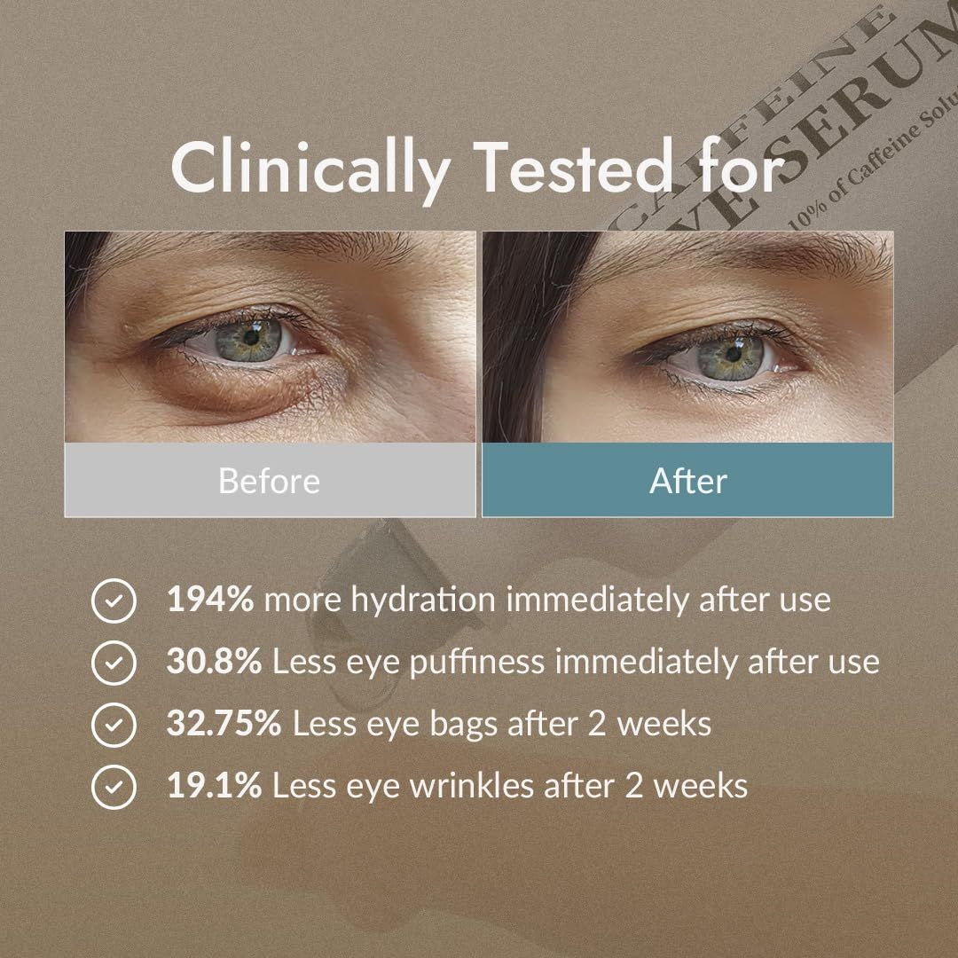 Confronto prima e dopo degli occhi. Testo: Clinicamente testato. Risultati: meno gonfiore, rughe e borse.