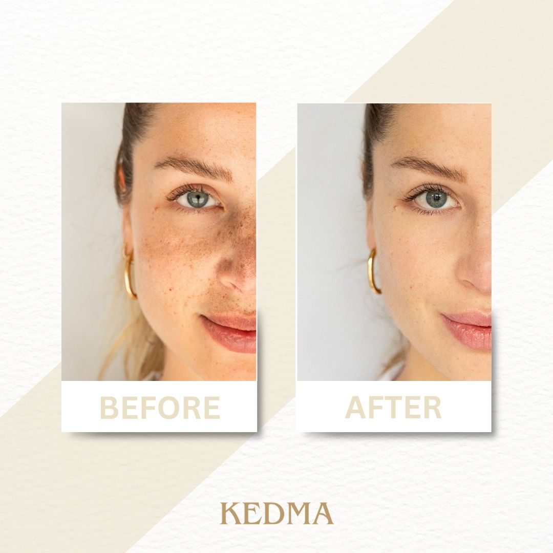 Kedma - Crema Notte Intensiva con Minerali del Mar Morto e Retinolo