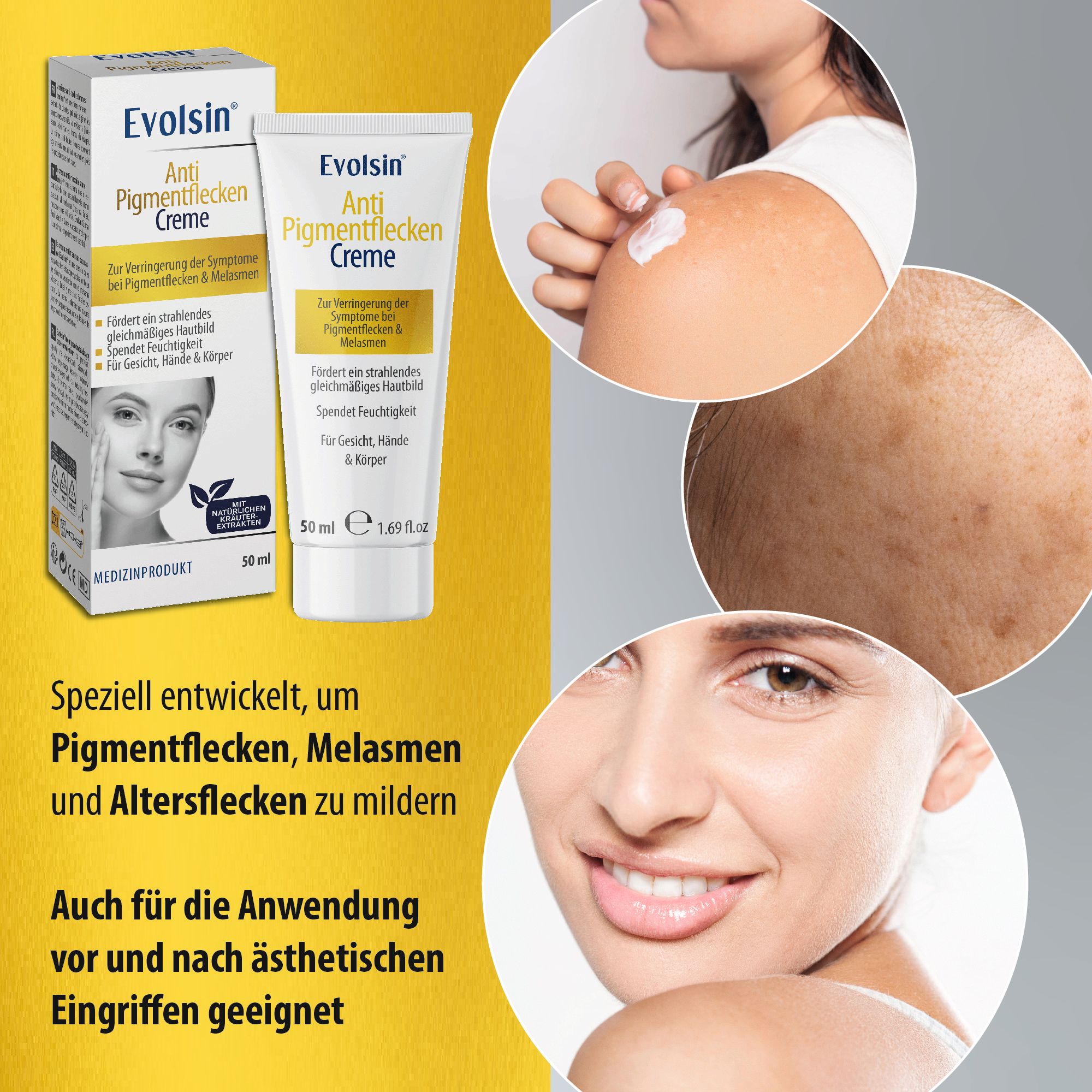 Immagine del prodotto ed esempi di pelle. Testo: EVOLSIN® Crema anti-macchie. Per macchie, melasma, macchie dell'età.