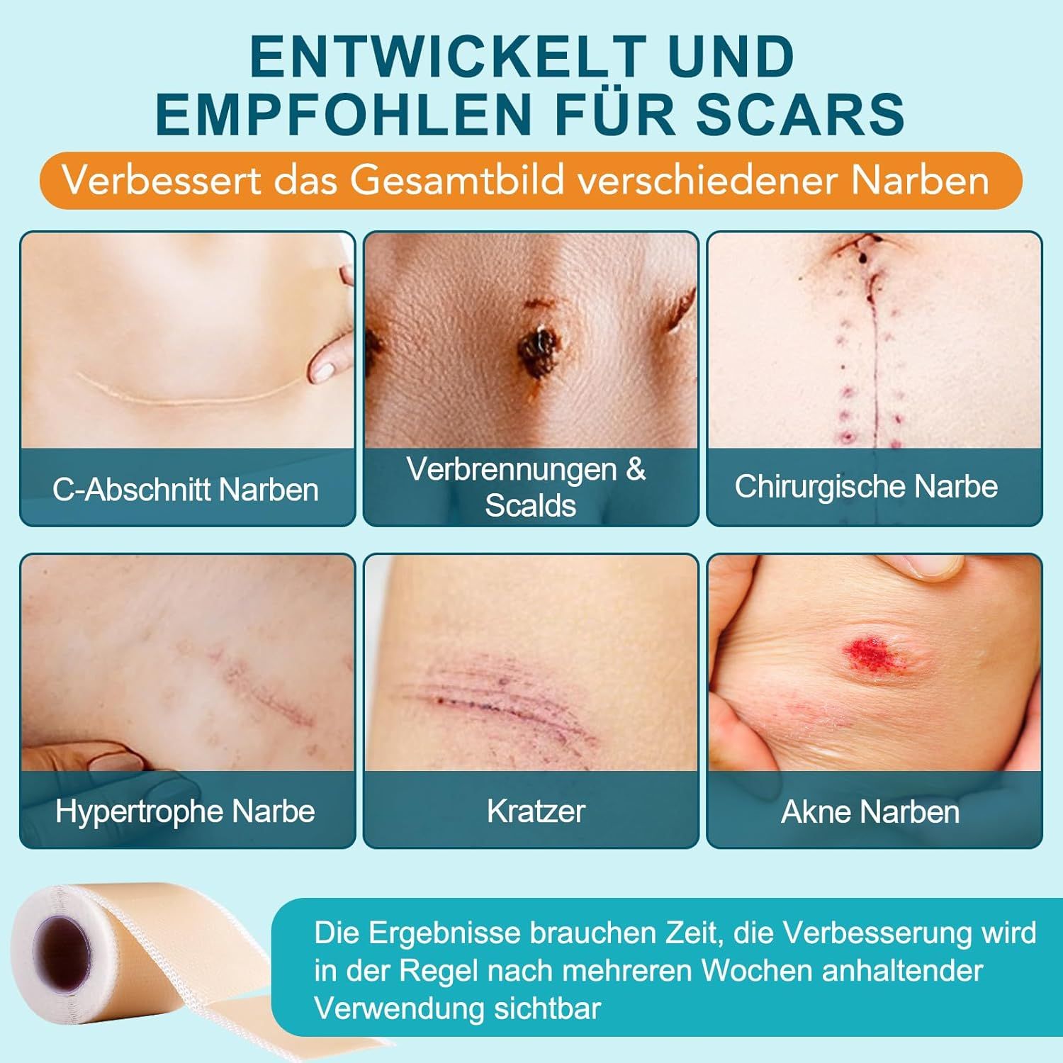 Esempi di cicatrici: taglio cesareo, ustioni, cicatrice chirurgica, cicatrice ipertrofica, graffi, cicatrici da acne. Rotolo di cerotto.