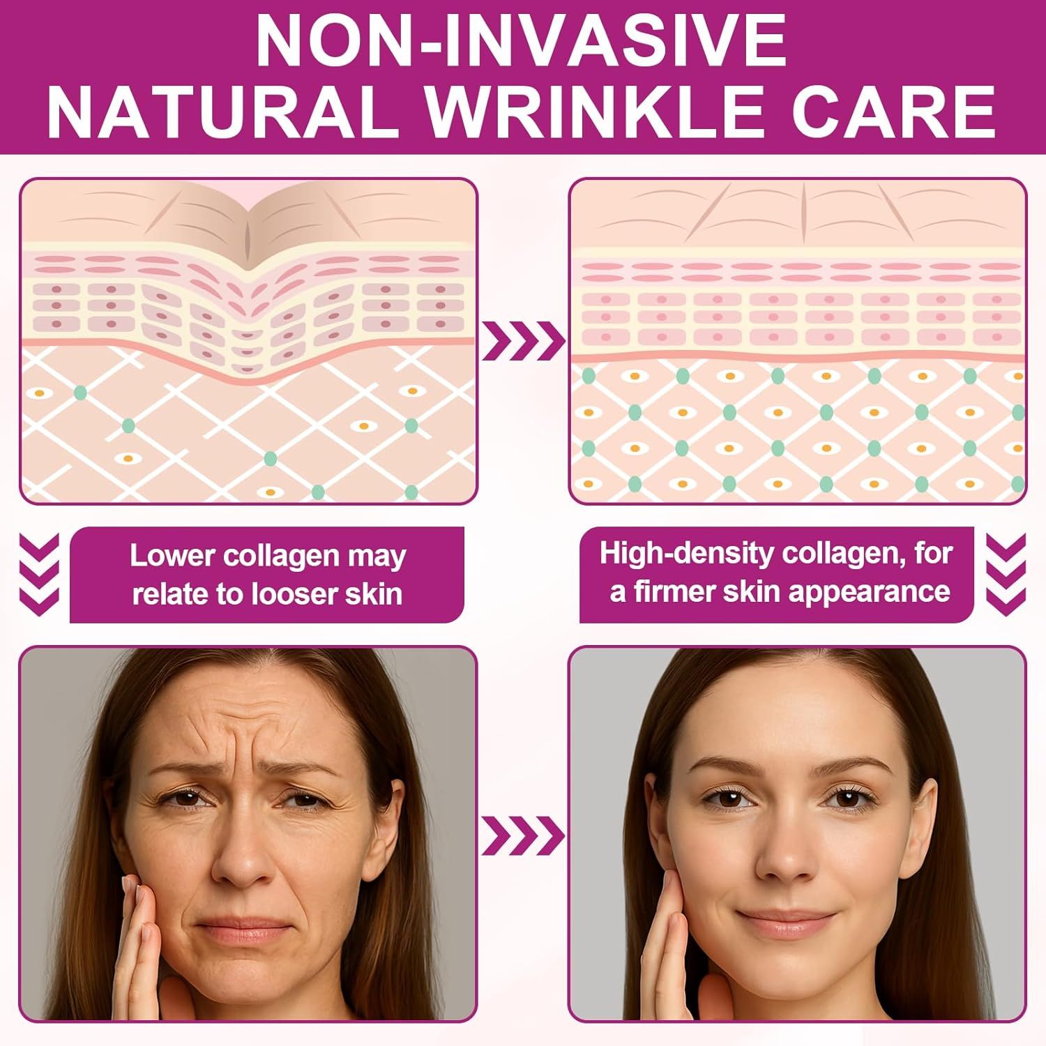 Confronto prima/dopo. Testo: Trattamento antirughe naturale non invasivo. Meno collagene, pelle più soda. Prima: rughe. Dopo: pelle più liscia.