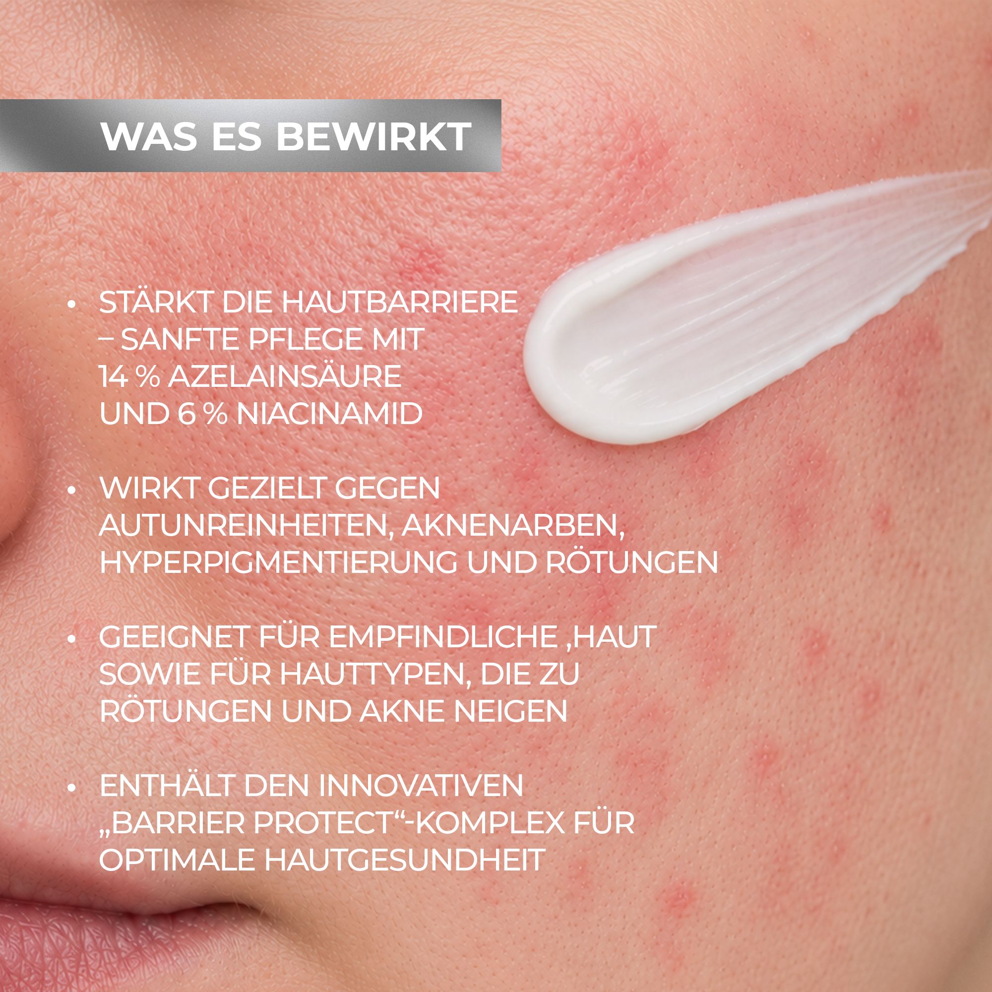 Biotrade AzeB3 Barrier Protect Crema viso con acido azelaico 14% e niacinamide 6%