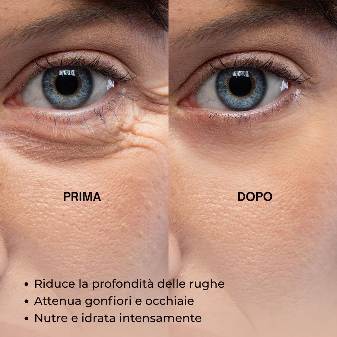 Immagine prima-dopo. Contorno occhi con rughe e occhiaie. Dopo: meno rughe, meno occhiaie, idratazione intensa.