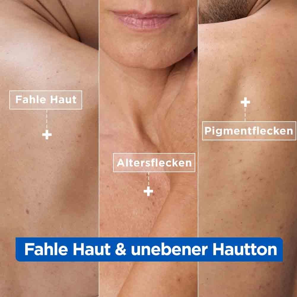 Tre sezioni di pelle con segni. Testo: Pelle spenta, macchie dell'età, macchie pigmentarie. Testo: Pelle spenta e tono non uniforme.