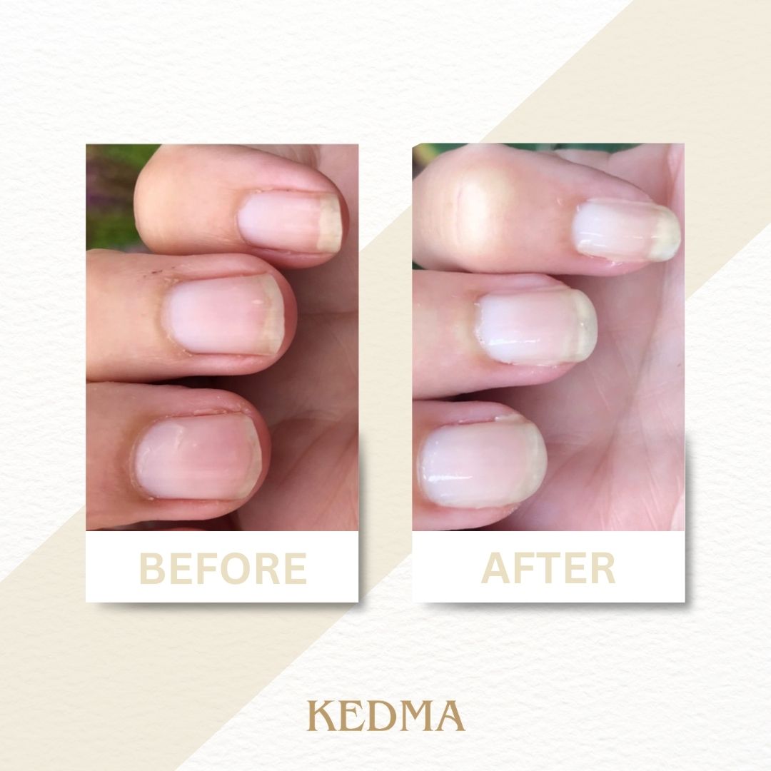 Kedma - Set Cura Unghie Golden Touch con Minerali del Mar Morto