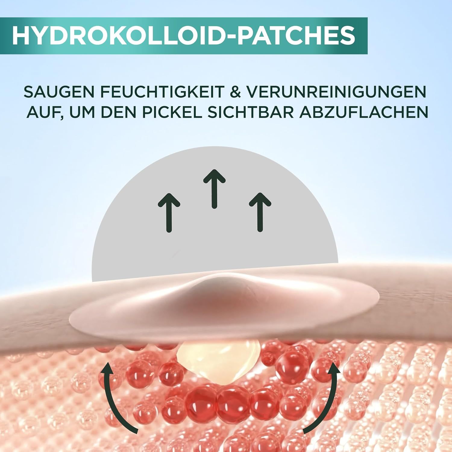 Primo piano di un cerotto idrocolloide. Frecce indicano l'assorbimento di liquido.