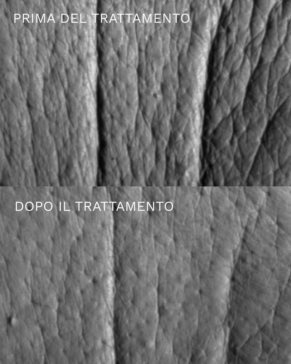 Due immagini della pelle: prima e dopo il trattamento. Notevole miglioramento della texture della pelle dopo il trattamento.
